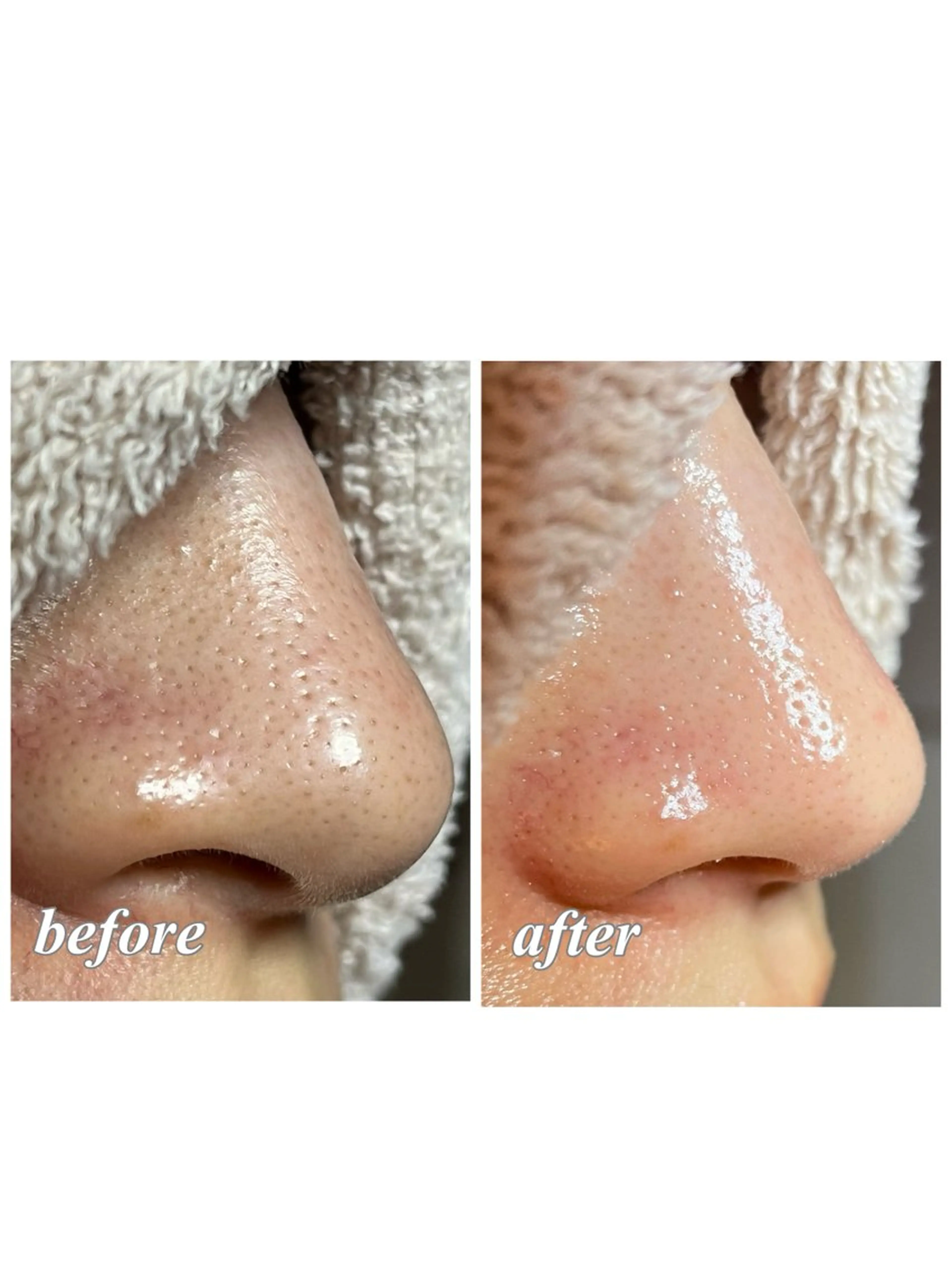 結果重視｜毛穴エステ ｜友綱理恵のエステ・リラクイメージ