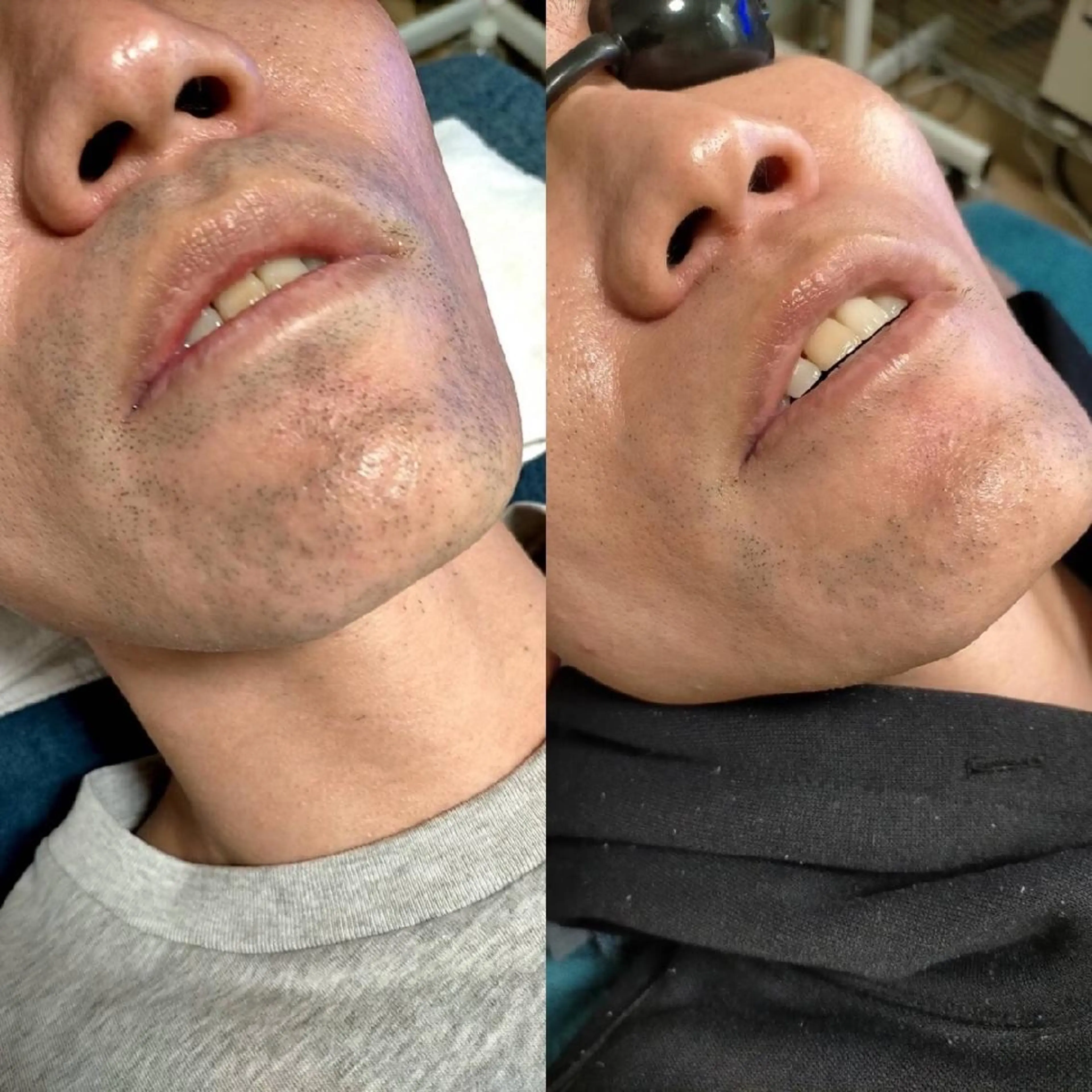 muscle＆esthe jonny's beauty所属・jonny's beautyのエステ・リラクイメージ