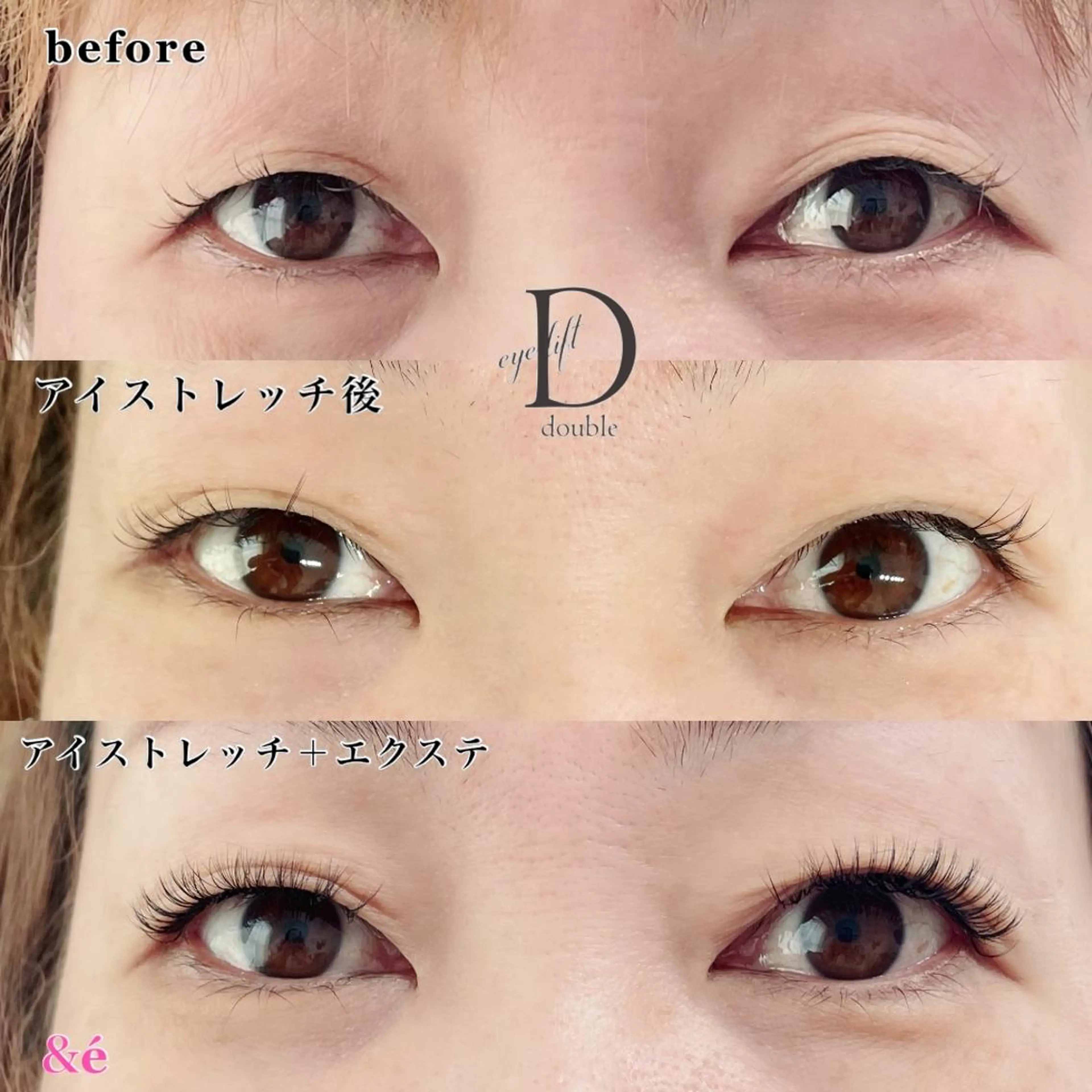 アイストレッチ＋シングルラッシュ100本の写真