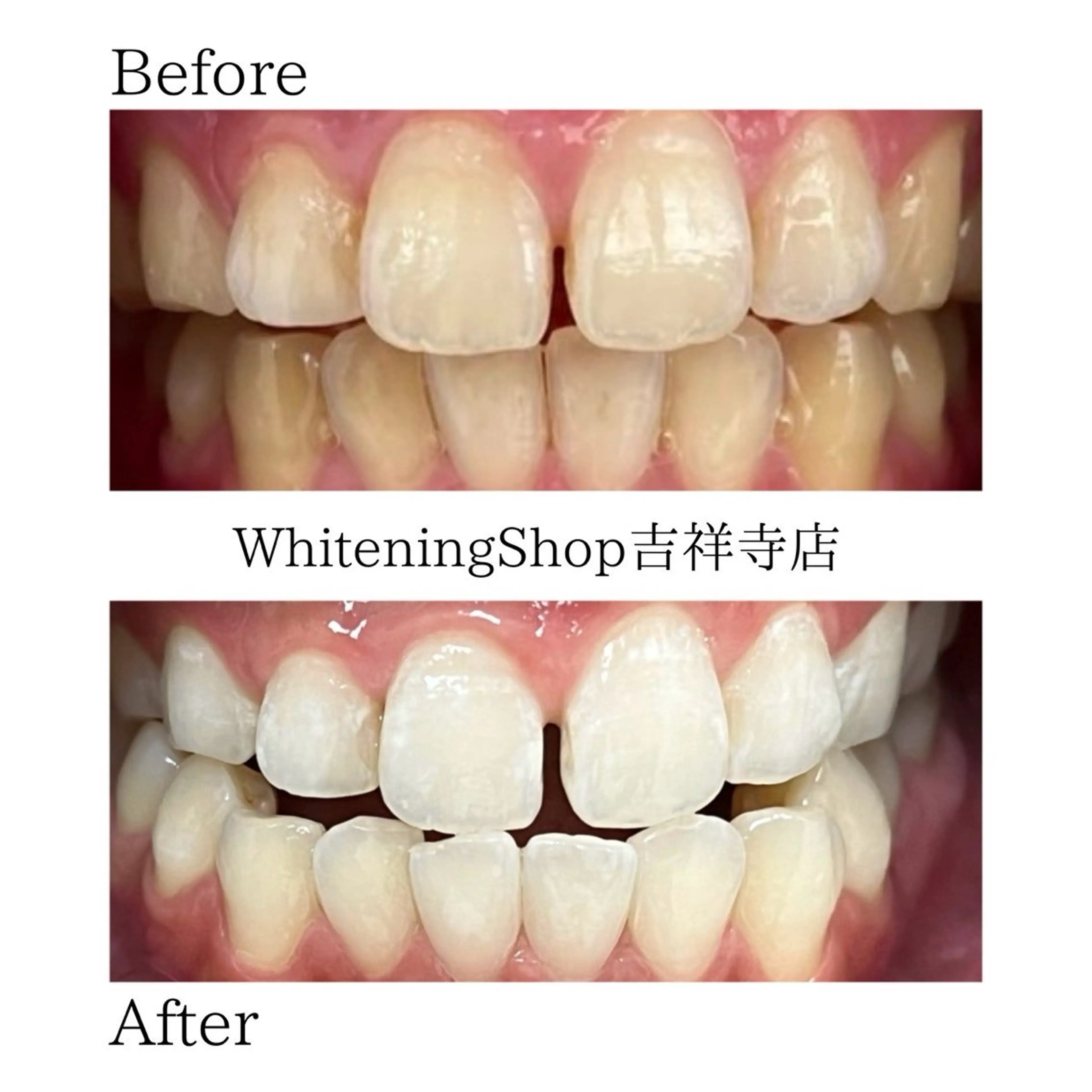 エステ リラク ホワイトニング ショップ吉祥寺店のエステ・リラクイメージ