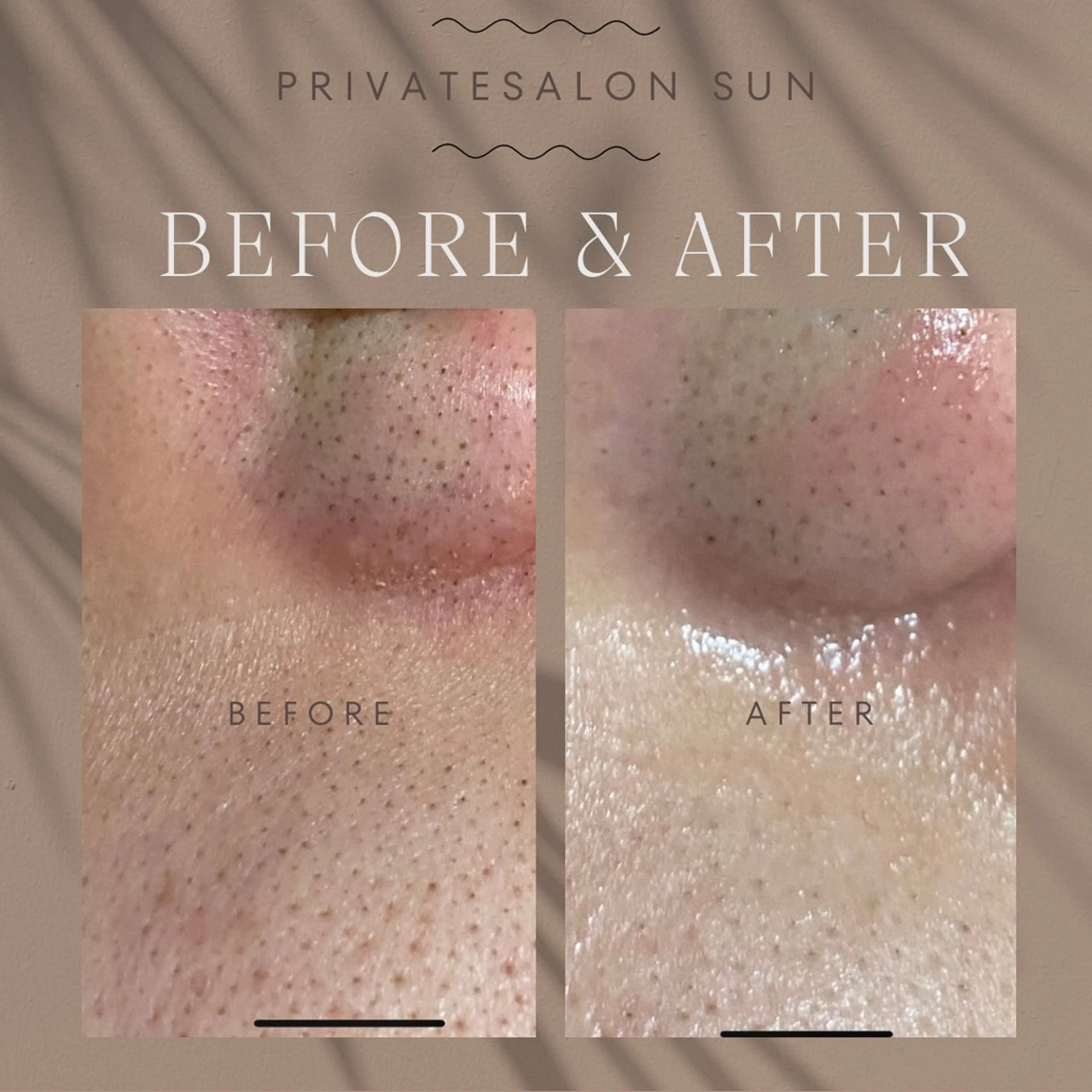 【肌質改善・腸揉み】 Nico laughのエステ・リラクイメージ