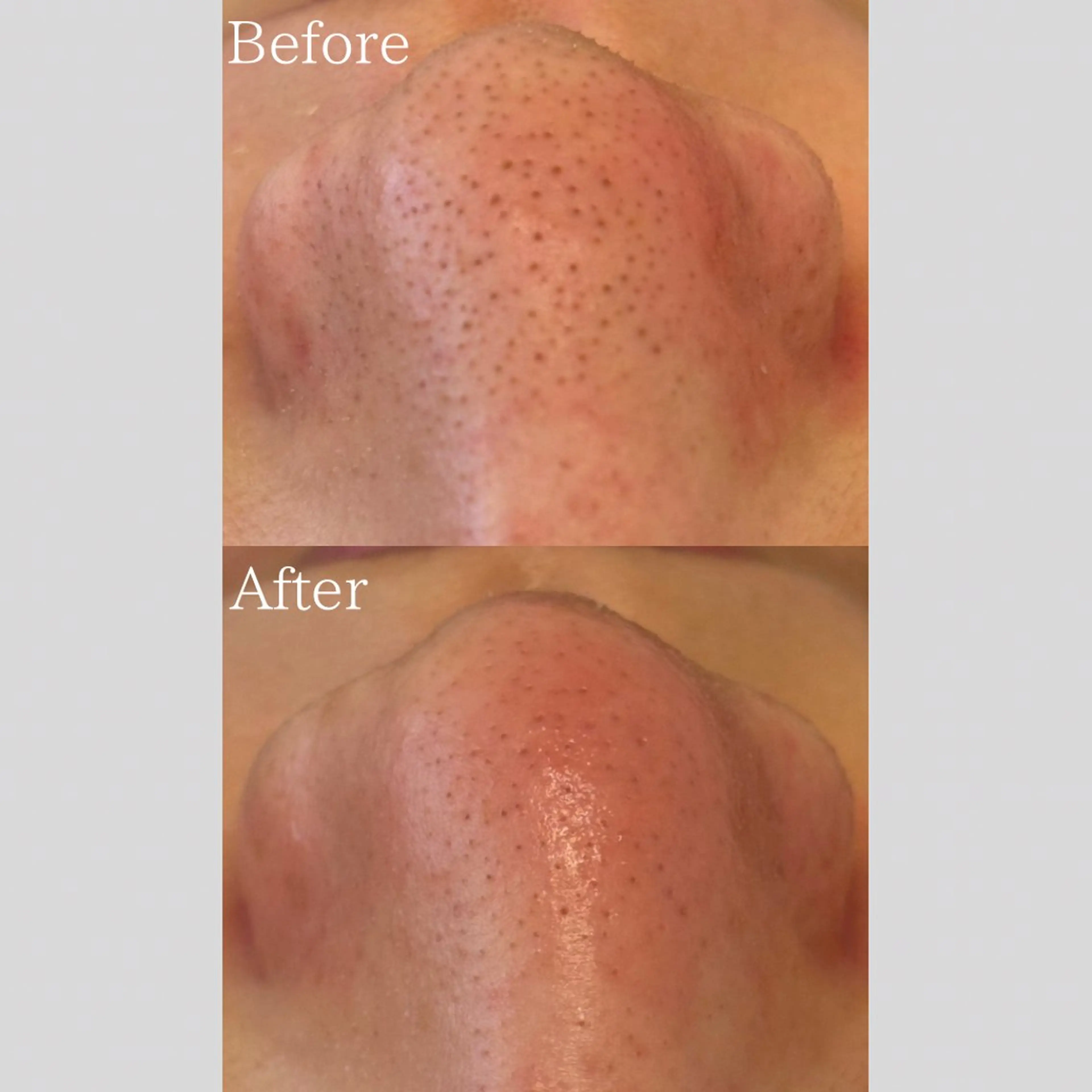 エステ リラク 韓国肌管理 【毛穴専科】のエステ・リラクイメージ