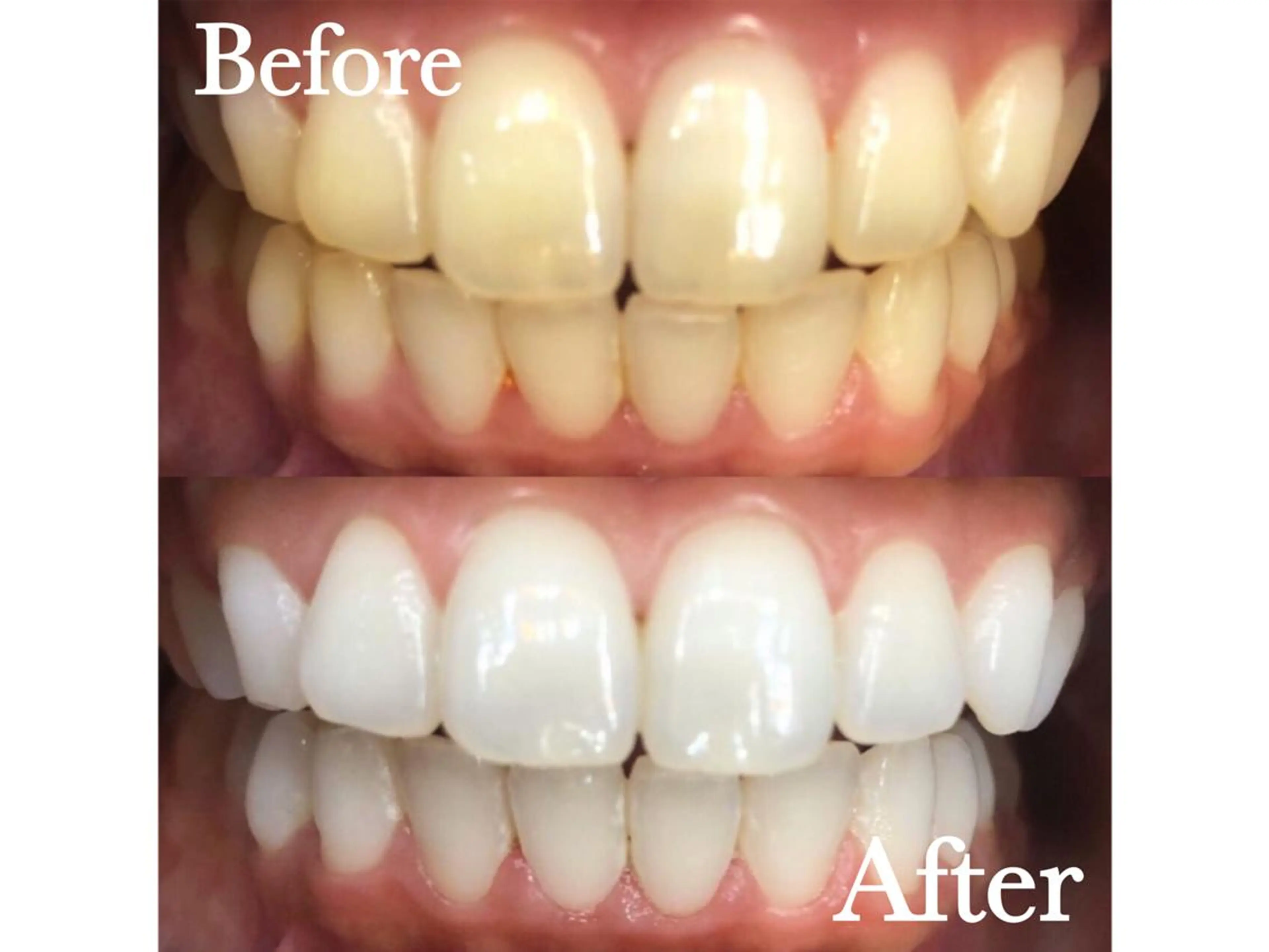 LBSホワイトニング 🌐渋谷店 公式のエステ・リラクイメージ