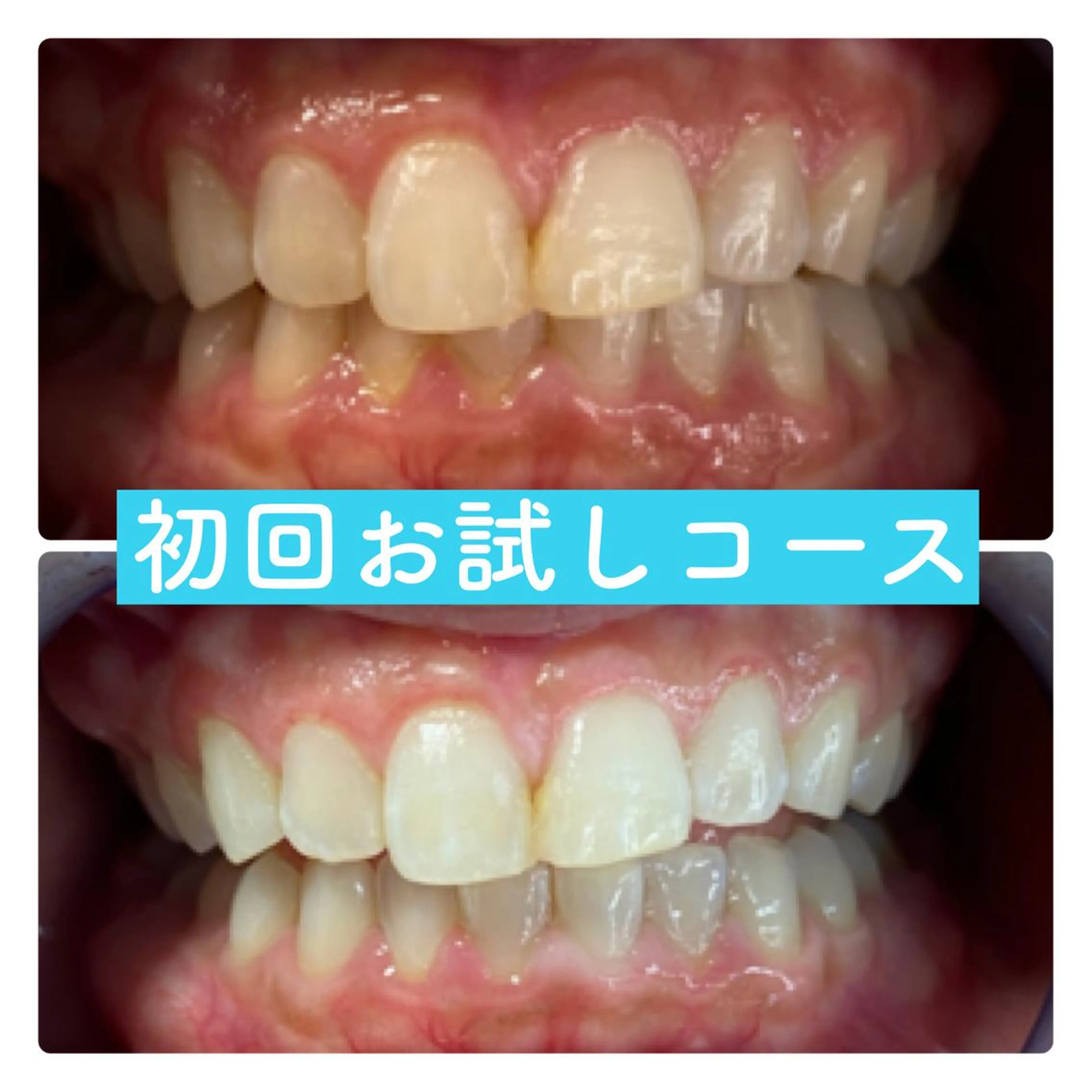 ホワイトニングルーム 横浜店のその他イメージ