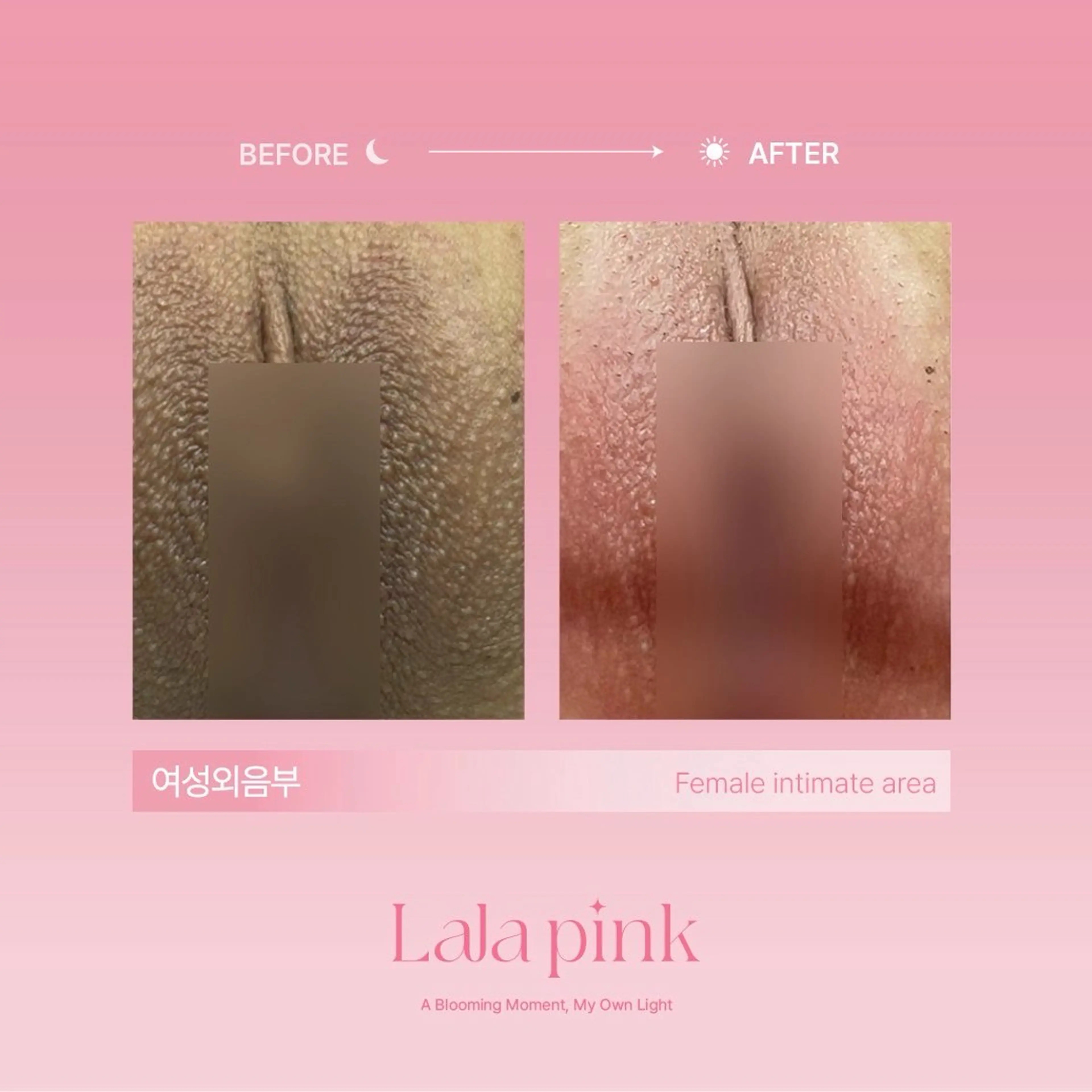 撮影モデル KIRAN 山﨑のエステ・リラクイメージ