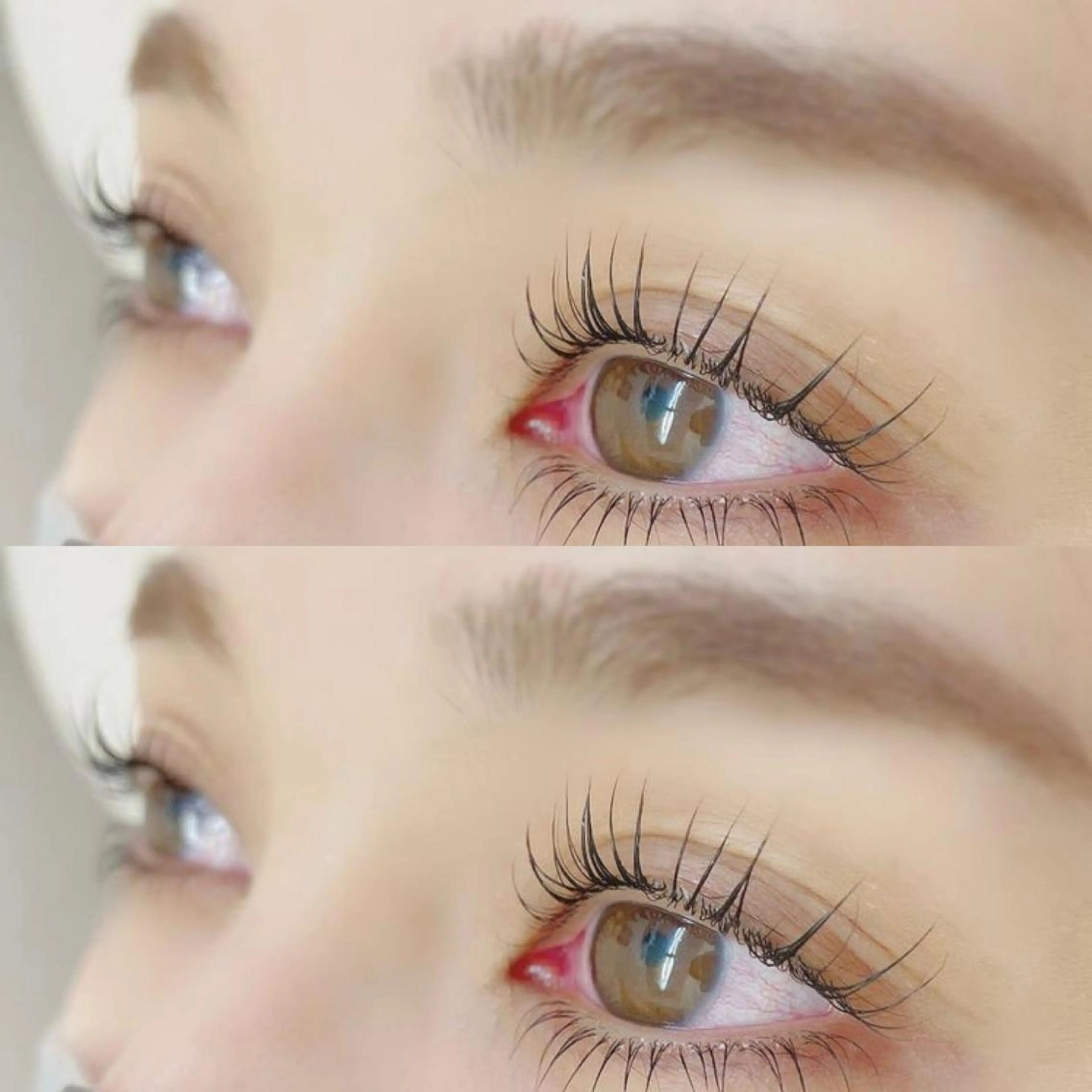 【 中顔面短縮🎀 】上下ラッシュリフト( 土日祝+550円 )の写真