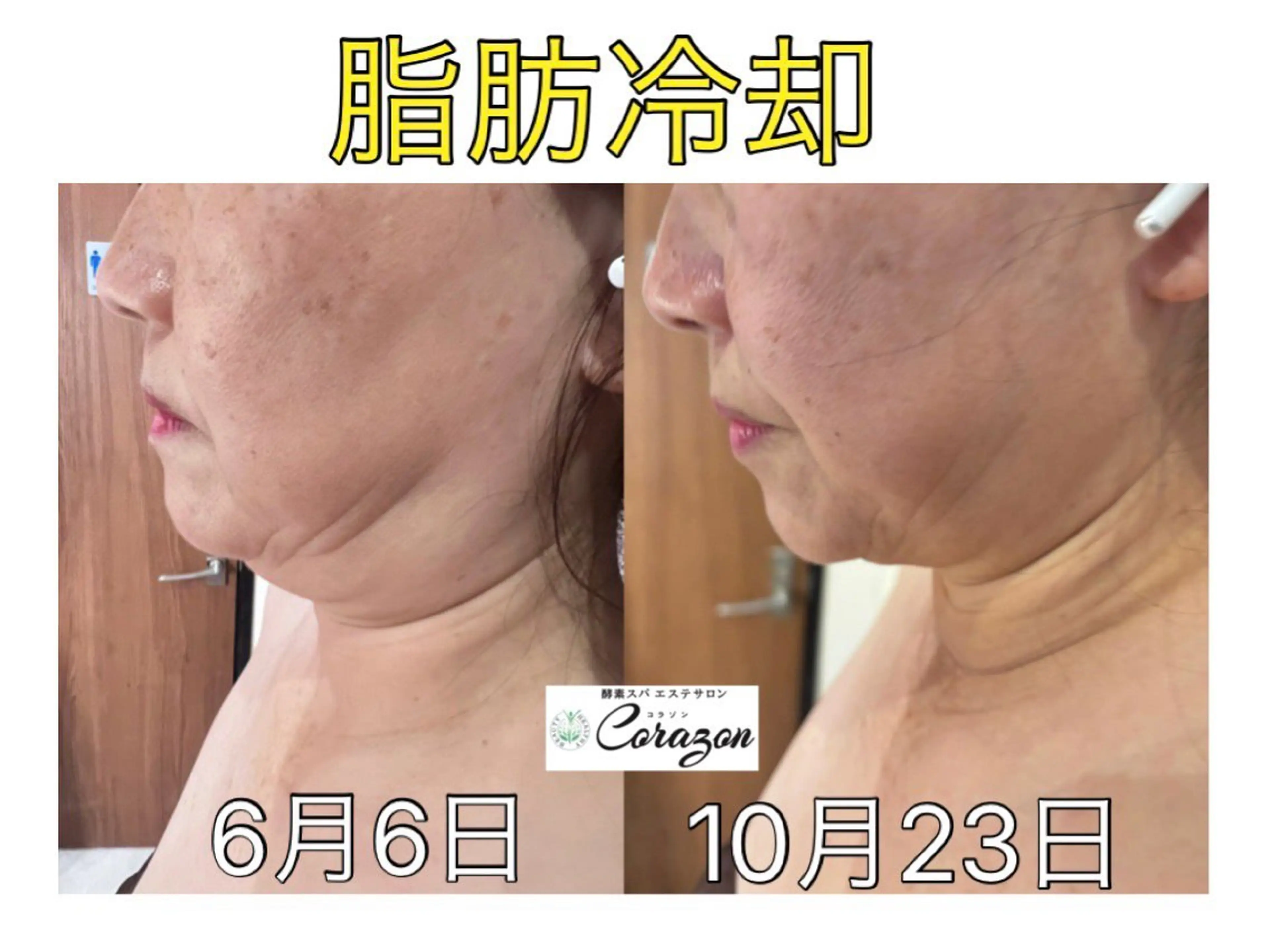 エステ Corazon コラゾンのマツエク・マツパデザイン