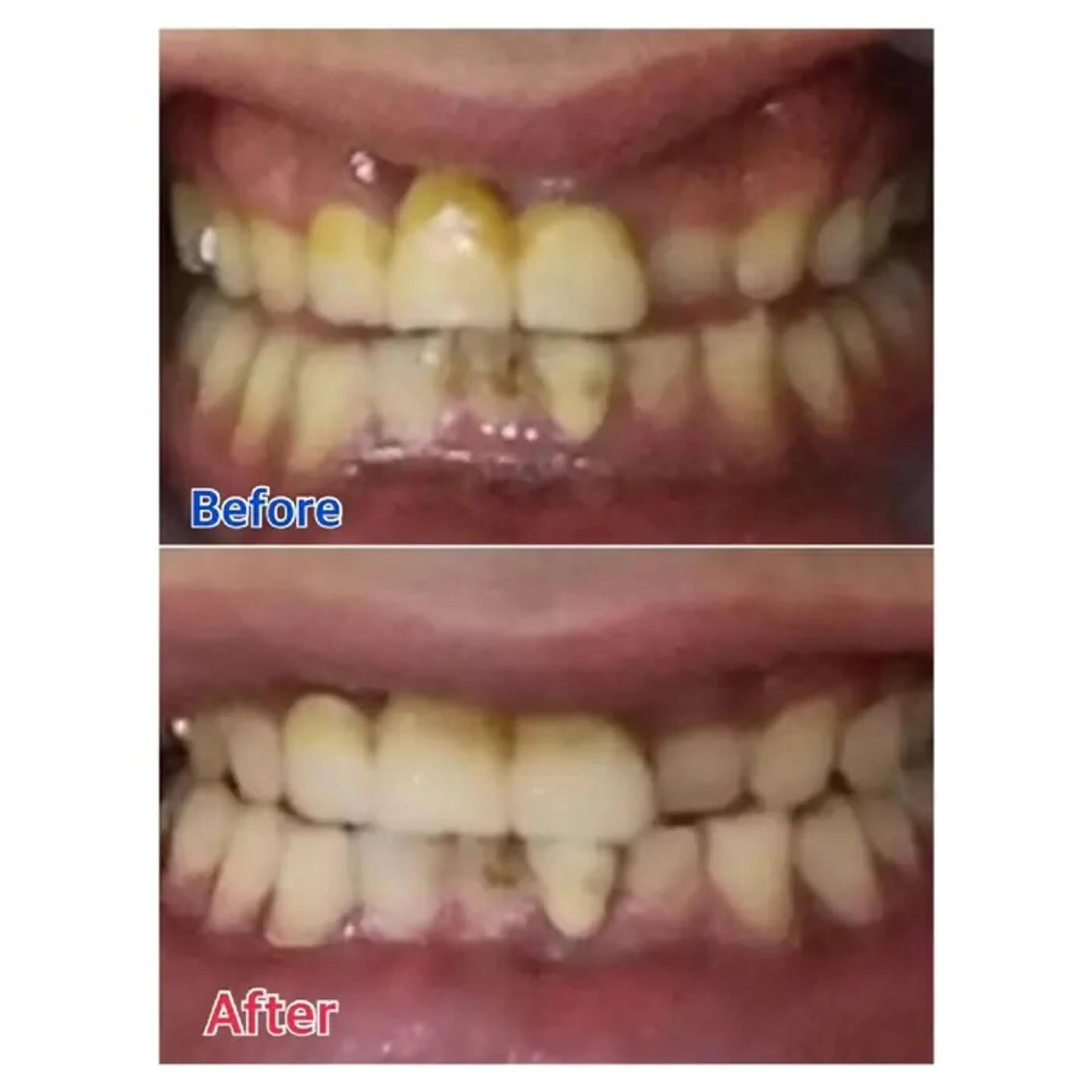 M渋谷 ホワイトニングのその他イメージ