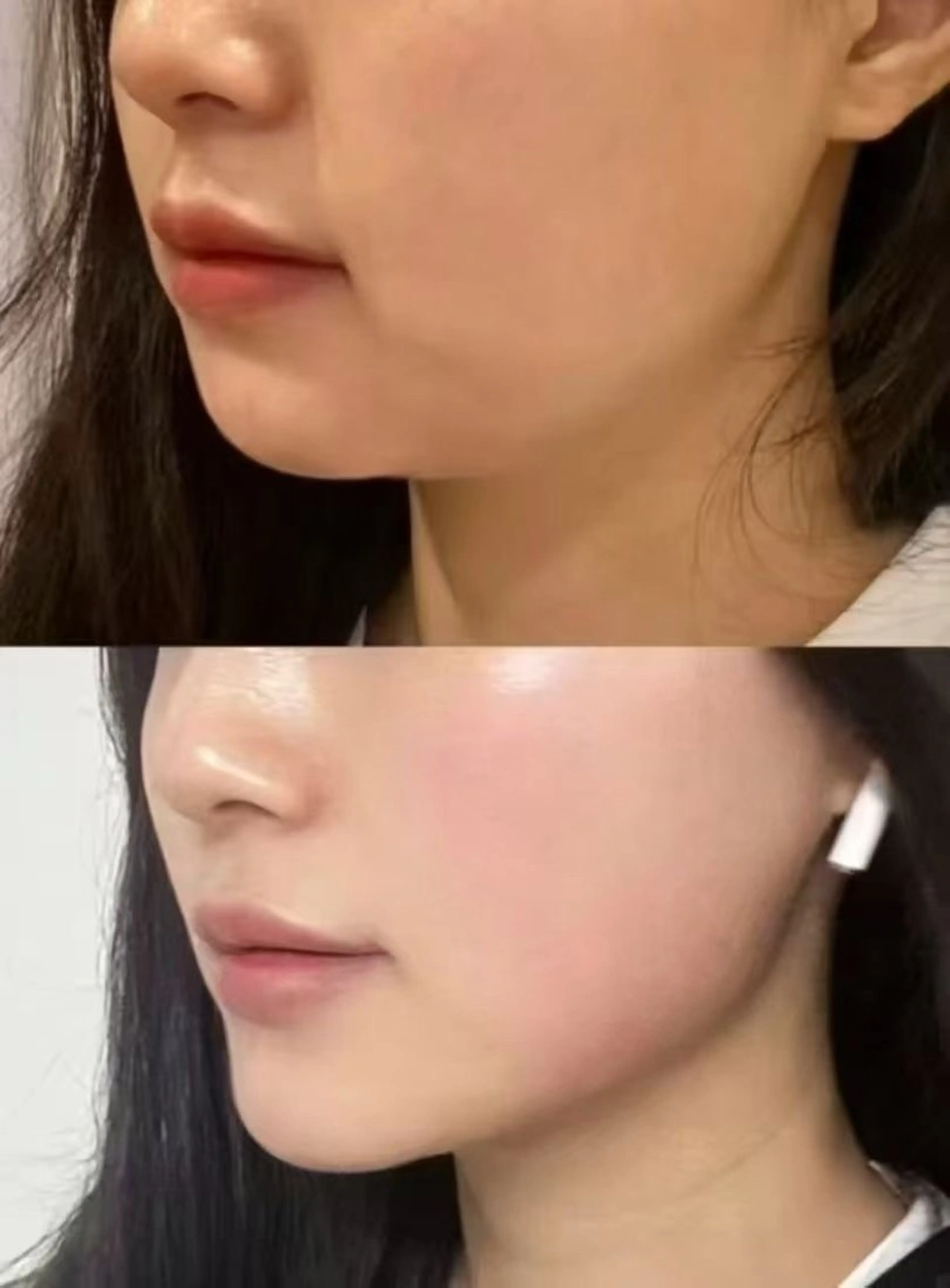 ネイル エステ aliaハイフ&水光ジェットサロン所属・aliaハーブ水光店 エステティシャン募集のエステ・リラクイメージ