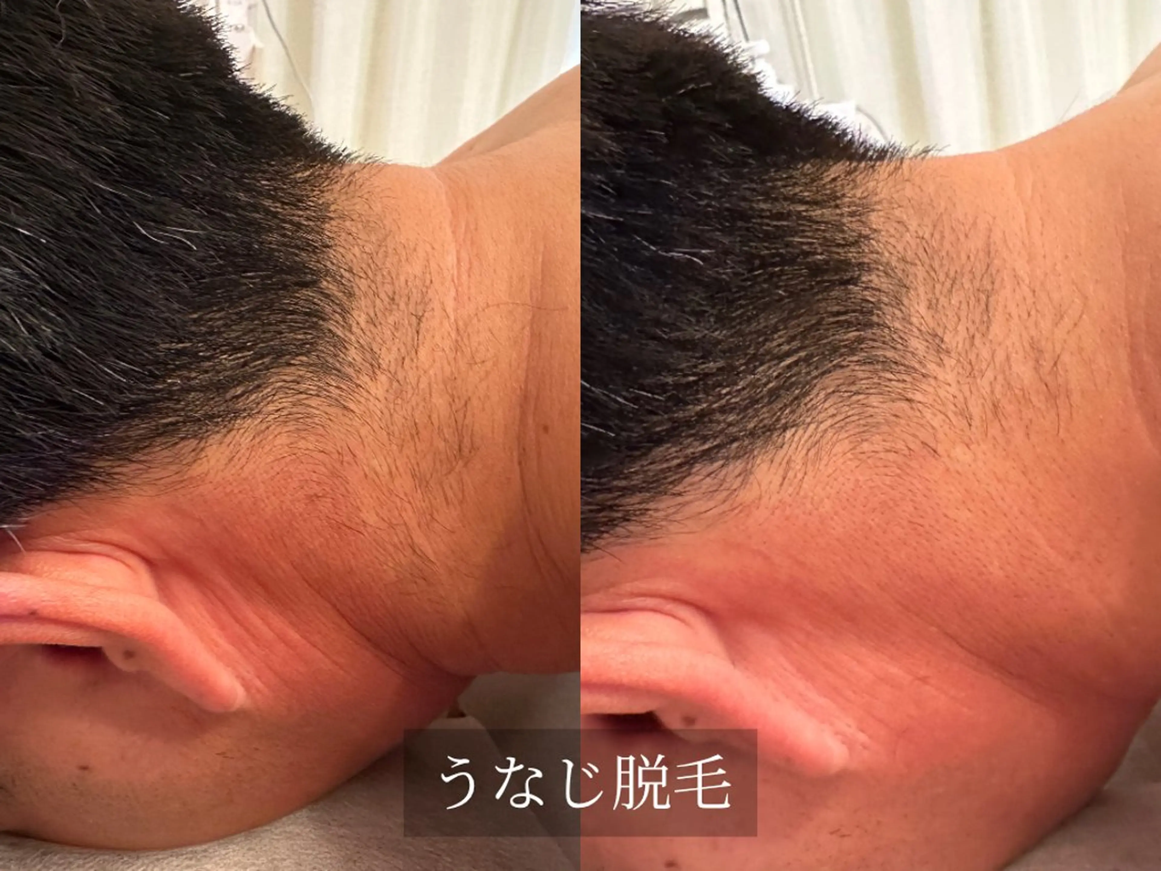 脱毛サロン Arumのエステ・リラクイメージ