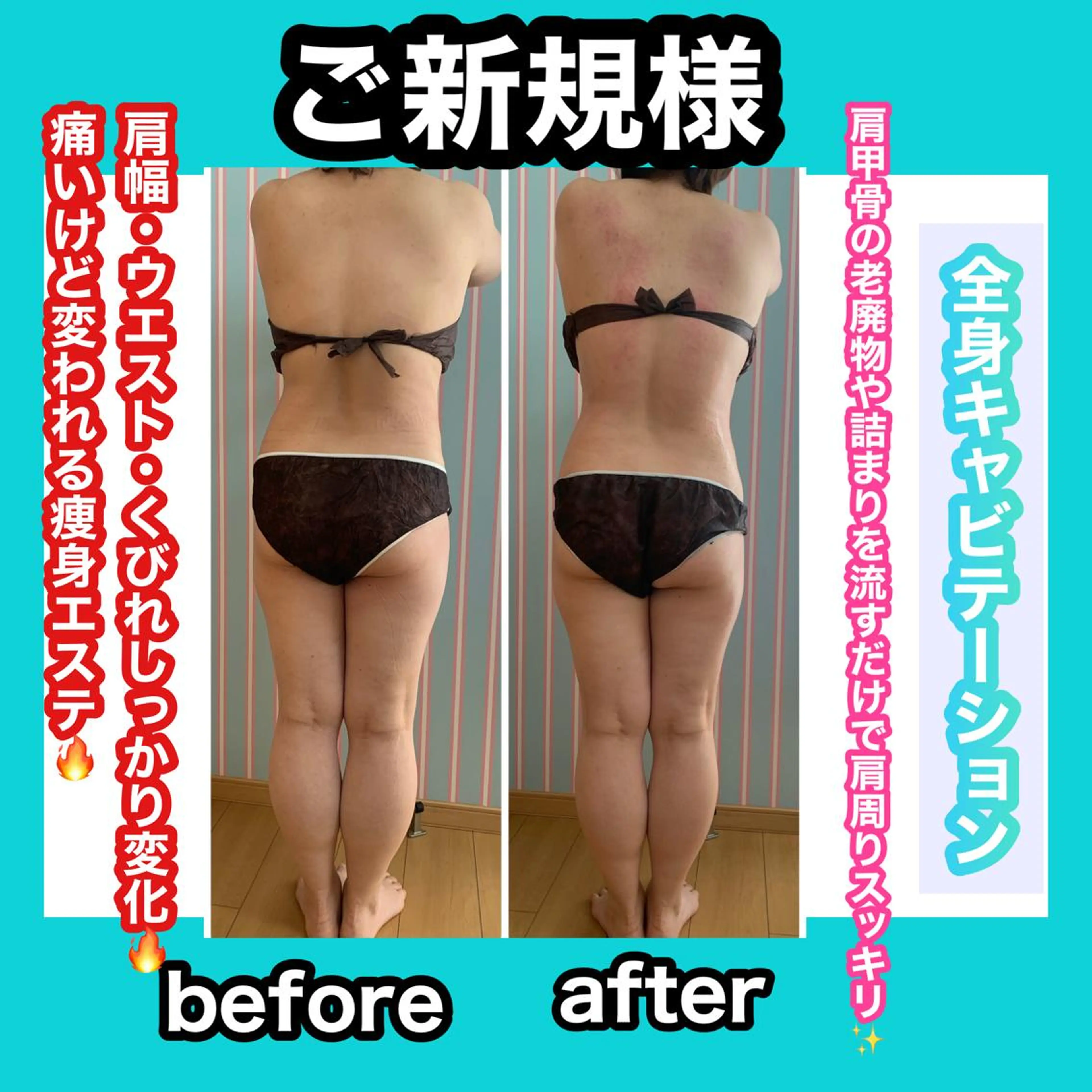 エステ リラク 痩身/脱毛/ネイル HARUKAのエステ・リラクイメージ