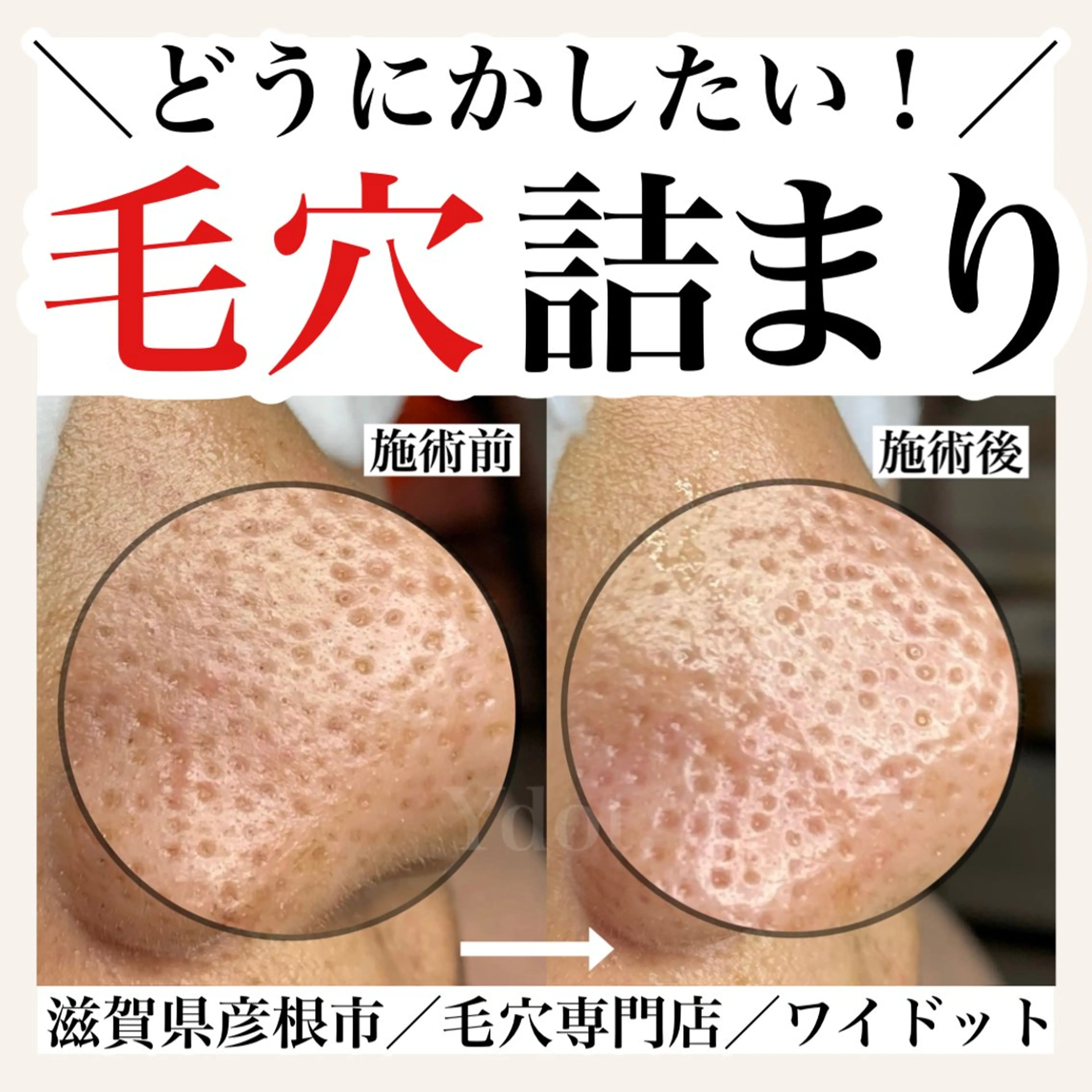 エステ Ydot. 池内 友架のエステ・リラクイメージ