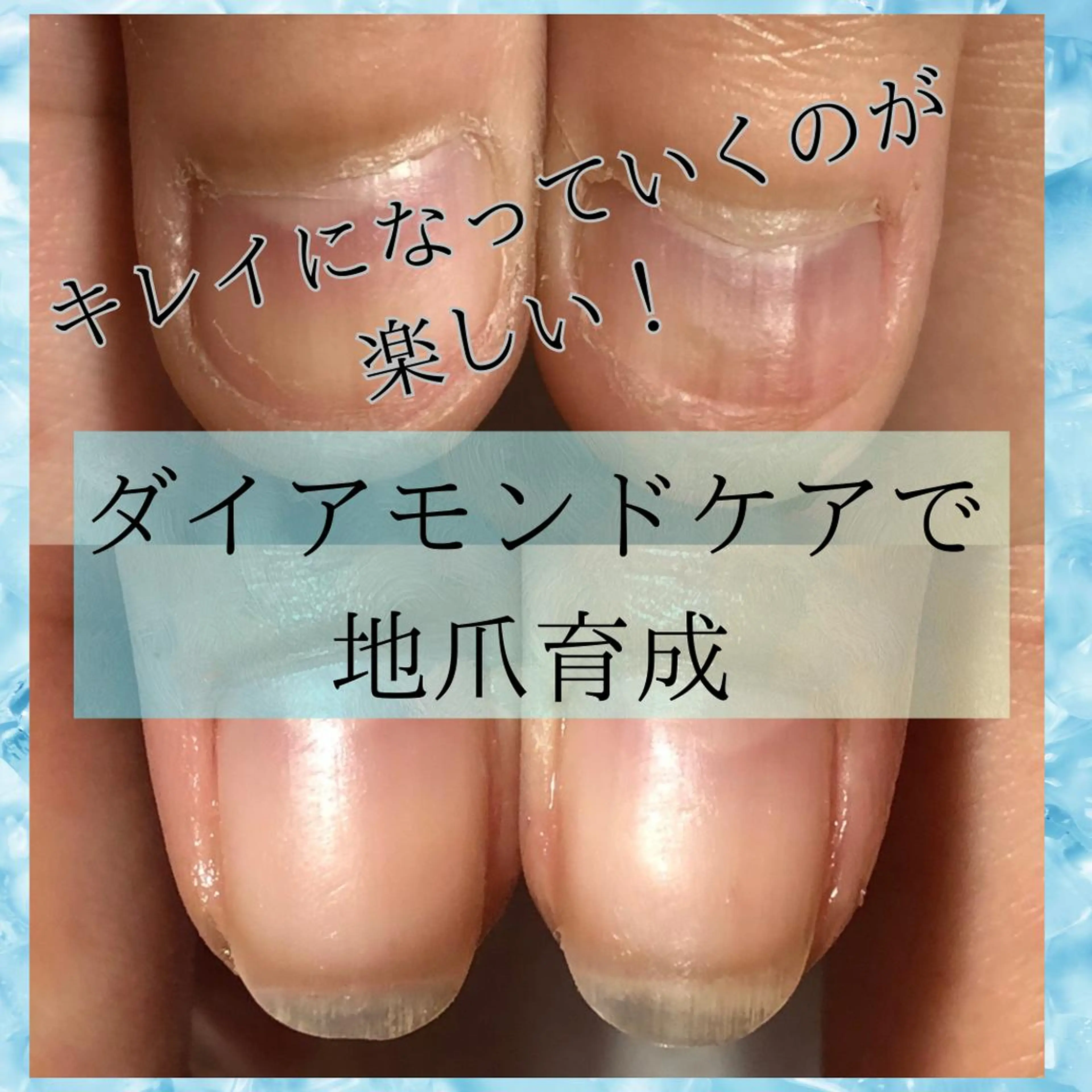 ネイル クリアネイル ジェルネイル ネイルケアサロン Campanulaのネイルデザイン