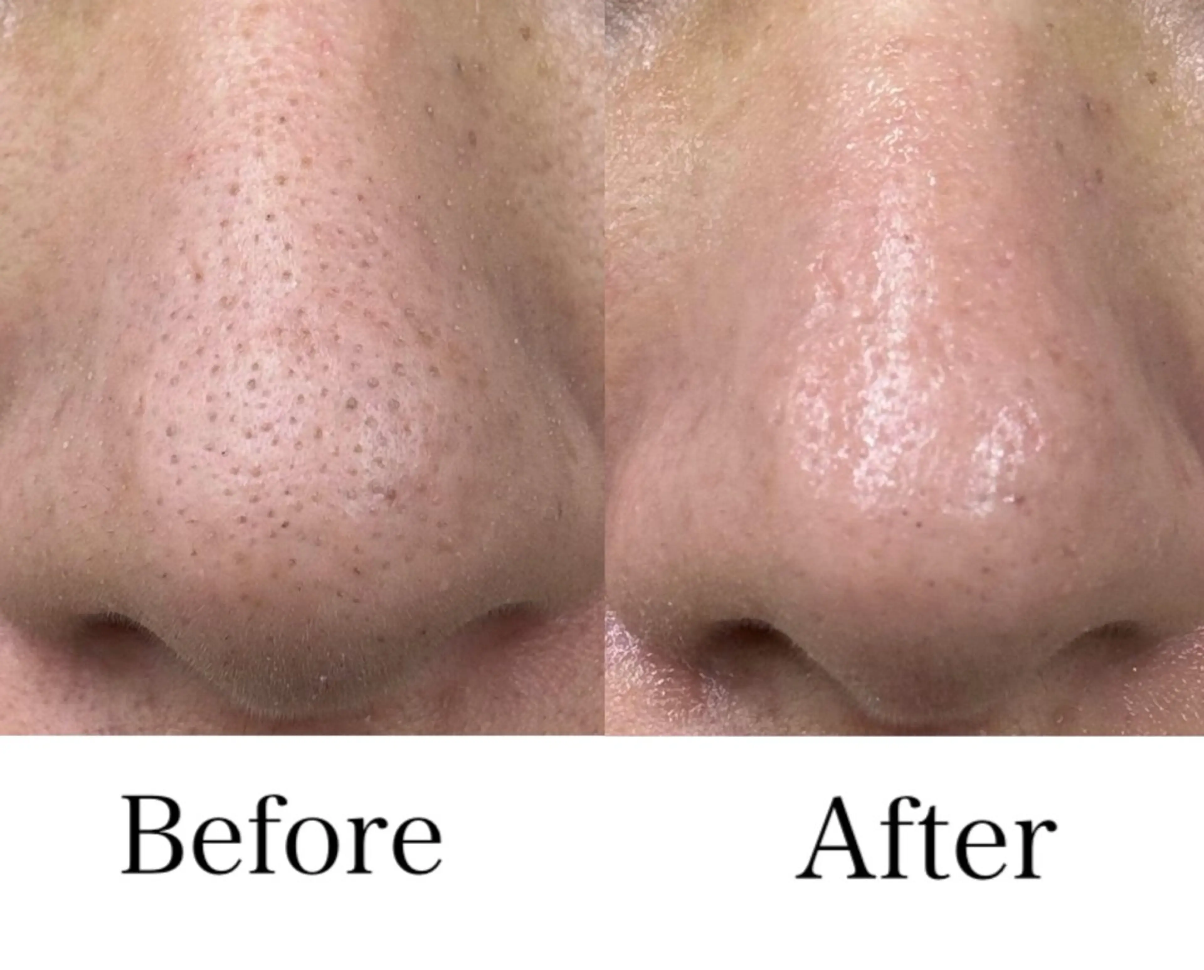 【ご新規様*角質/くすみ/毛穴/肌ケア】頭蓋骨小顔矯正+選べる肌ケア 通常16,000円→ミニモ限定初回10,700円の写真