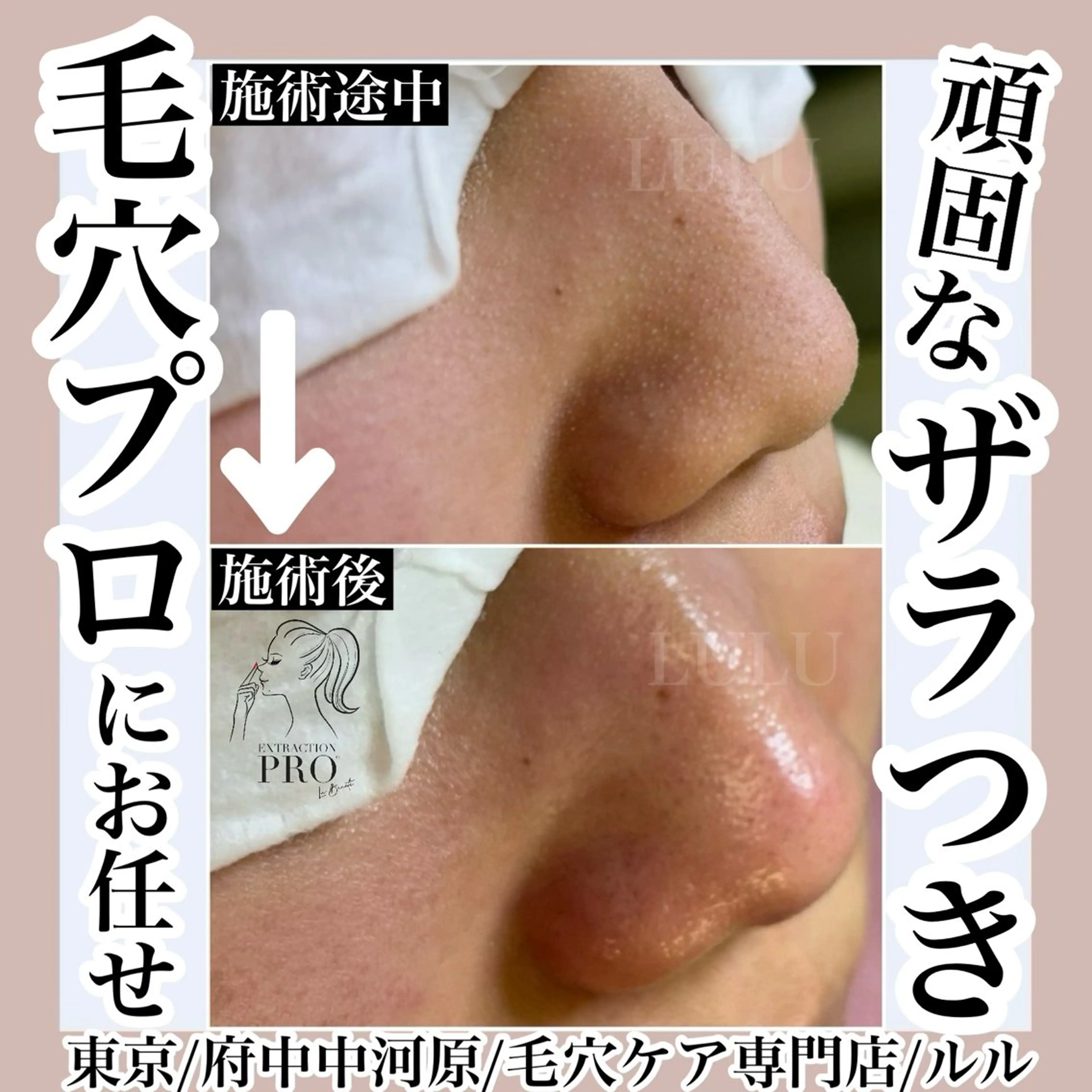 その他 LULU ルルのエステ・リラクイメージ