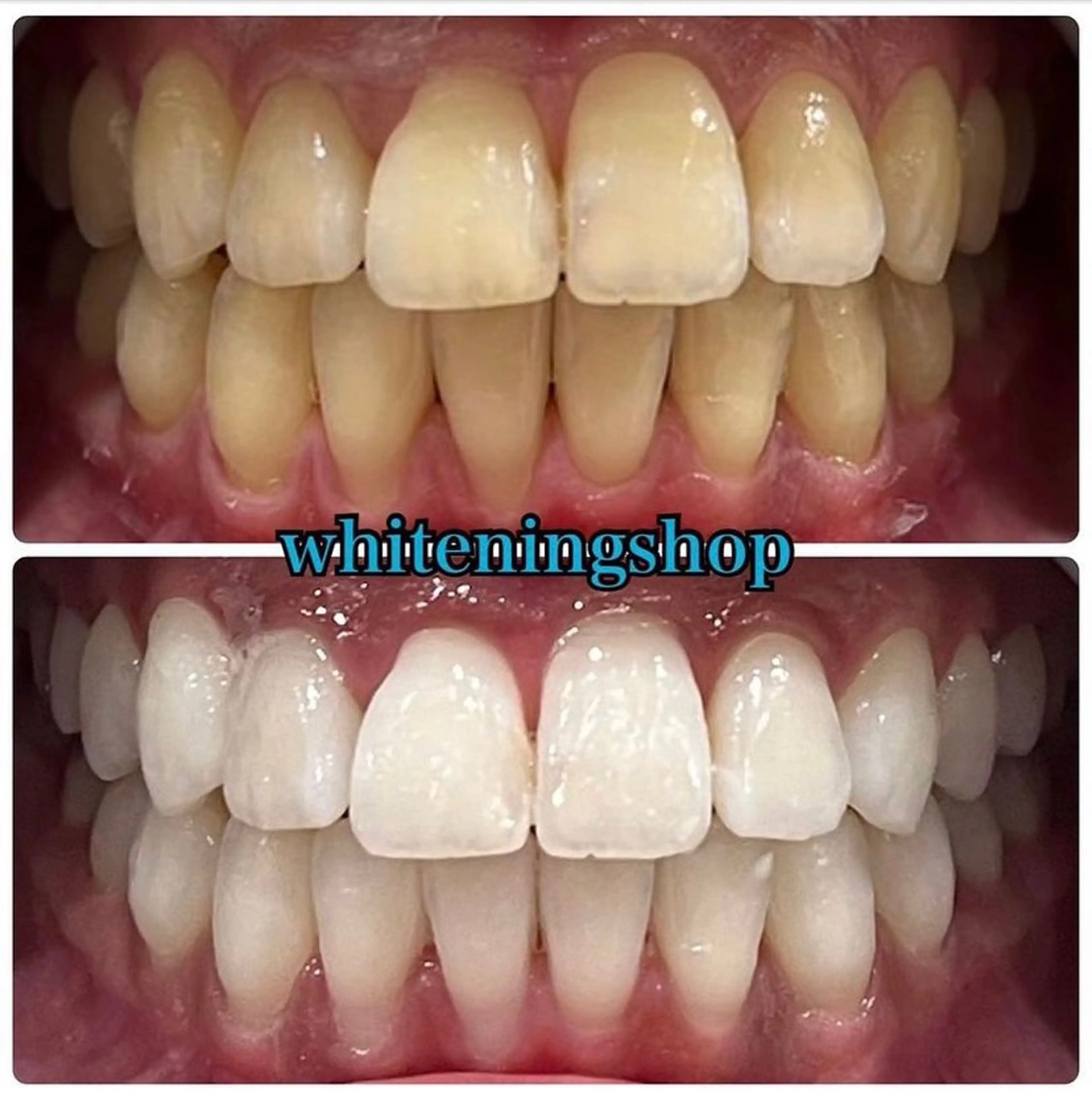 エステ リラク ホワイトニング ショップ吉祥寺店のエステ・リラクイメージ