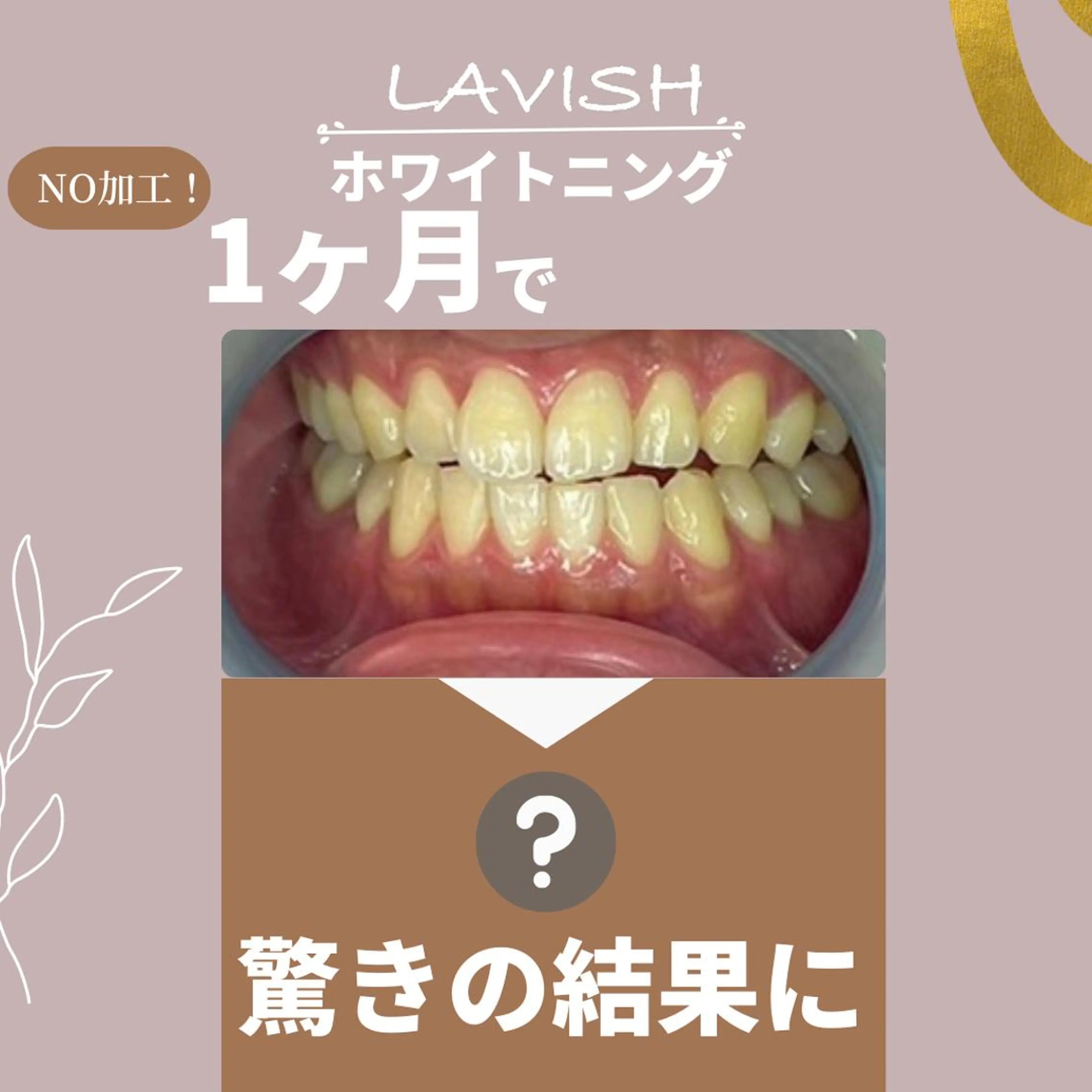 LAVISH nail salonのヘアスタイル