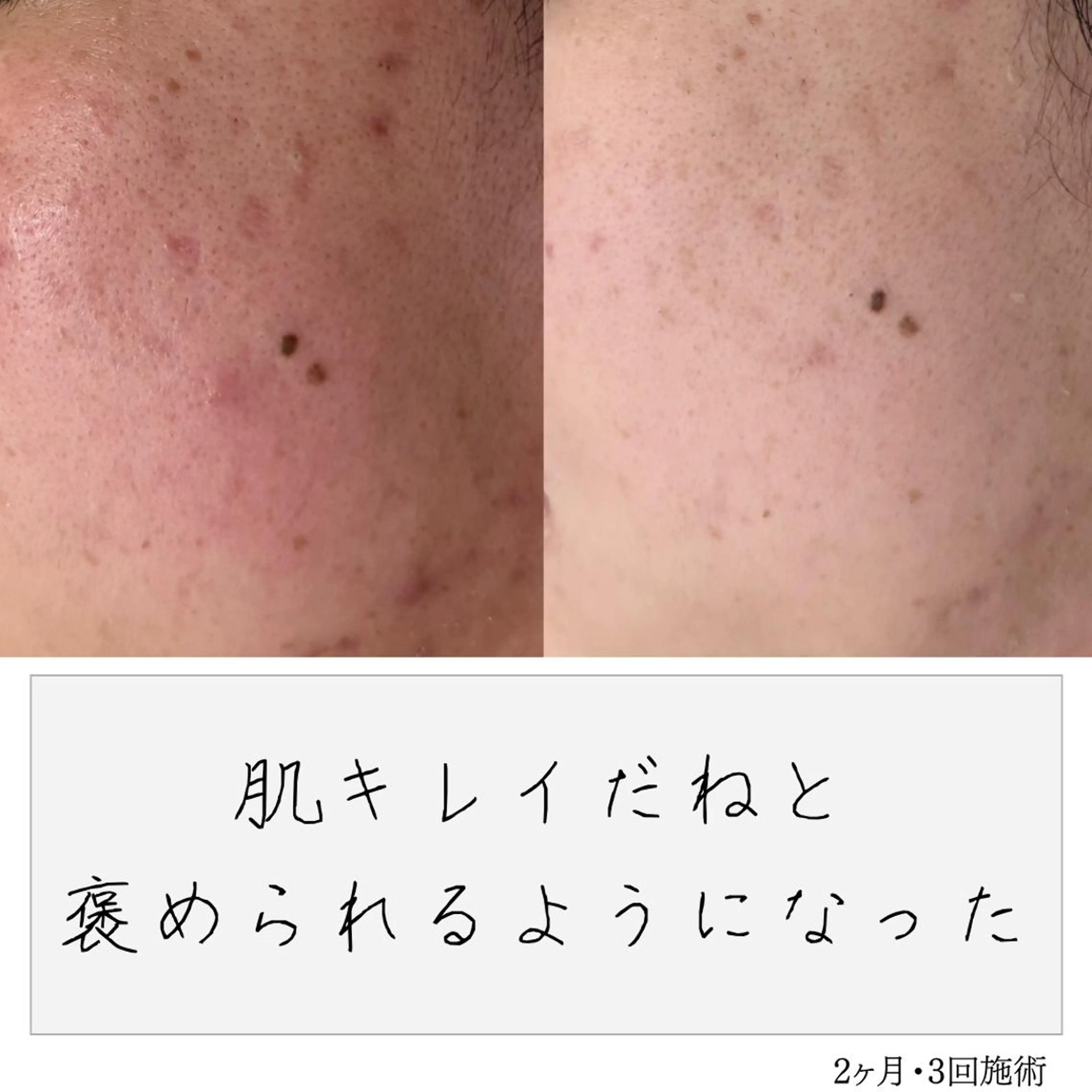 ニキビ経験者が施術 する専門サロン🌻のエステ・リラクイメージ
