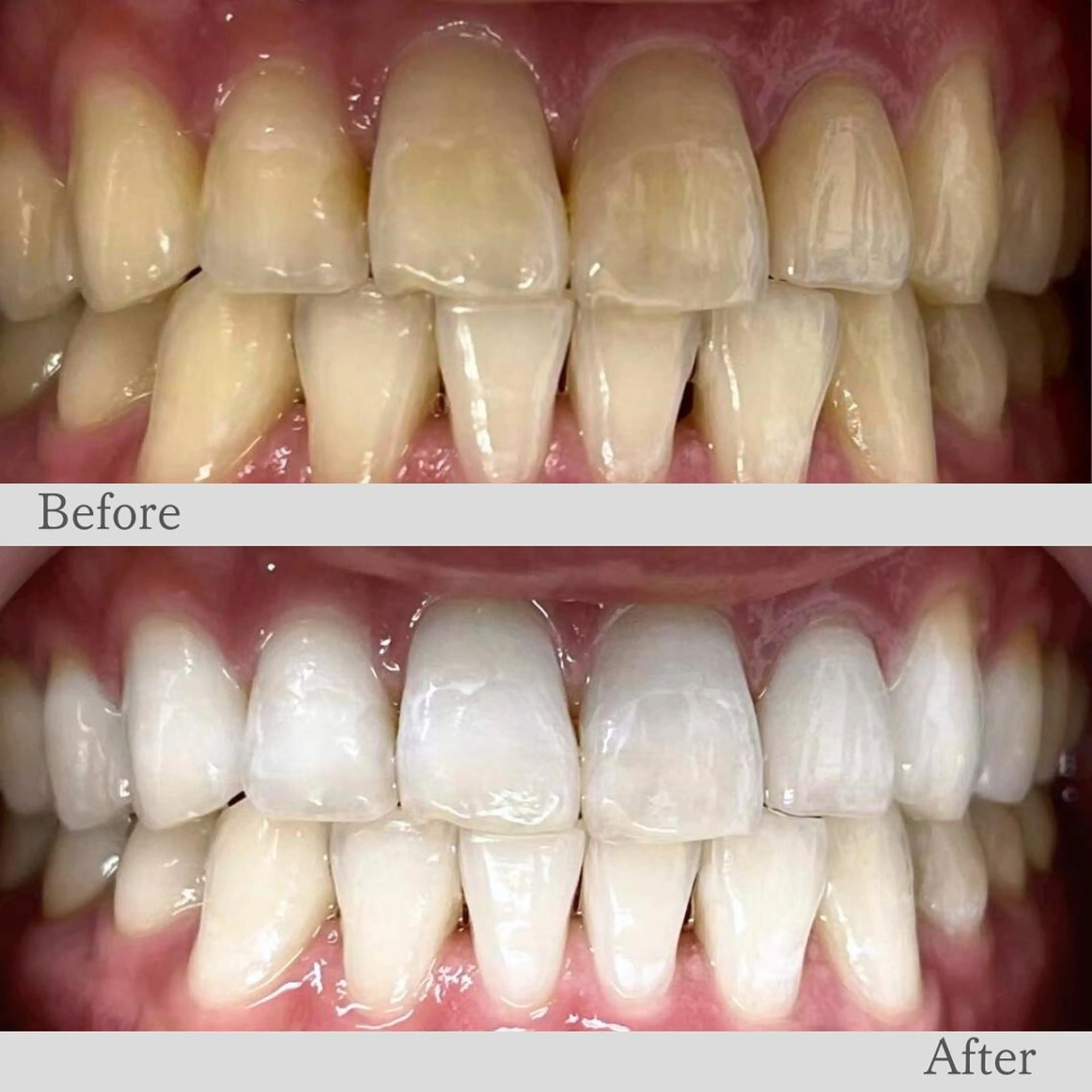 エステ リラク LBS吉祥寺 公式のエステ・リラクイメージ