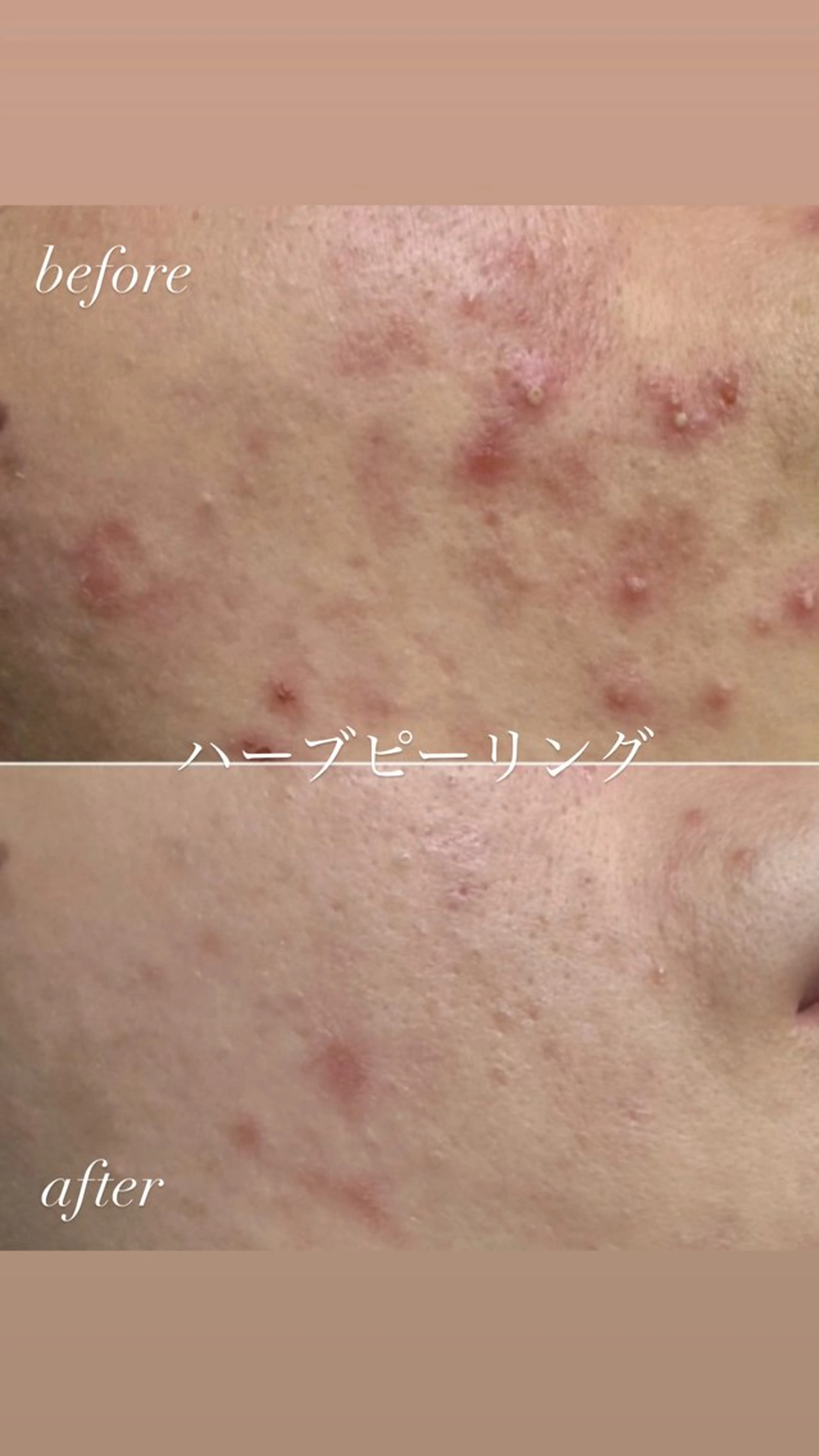 エステ リラク 肌質改善サロン réposのその他イメージ