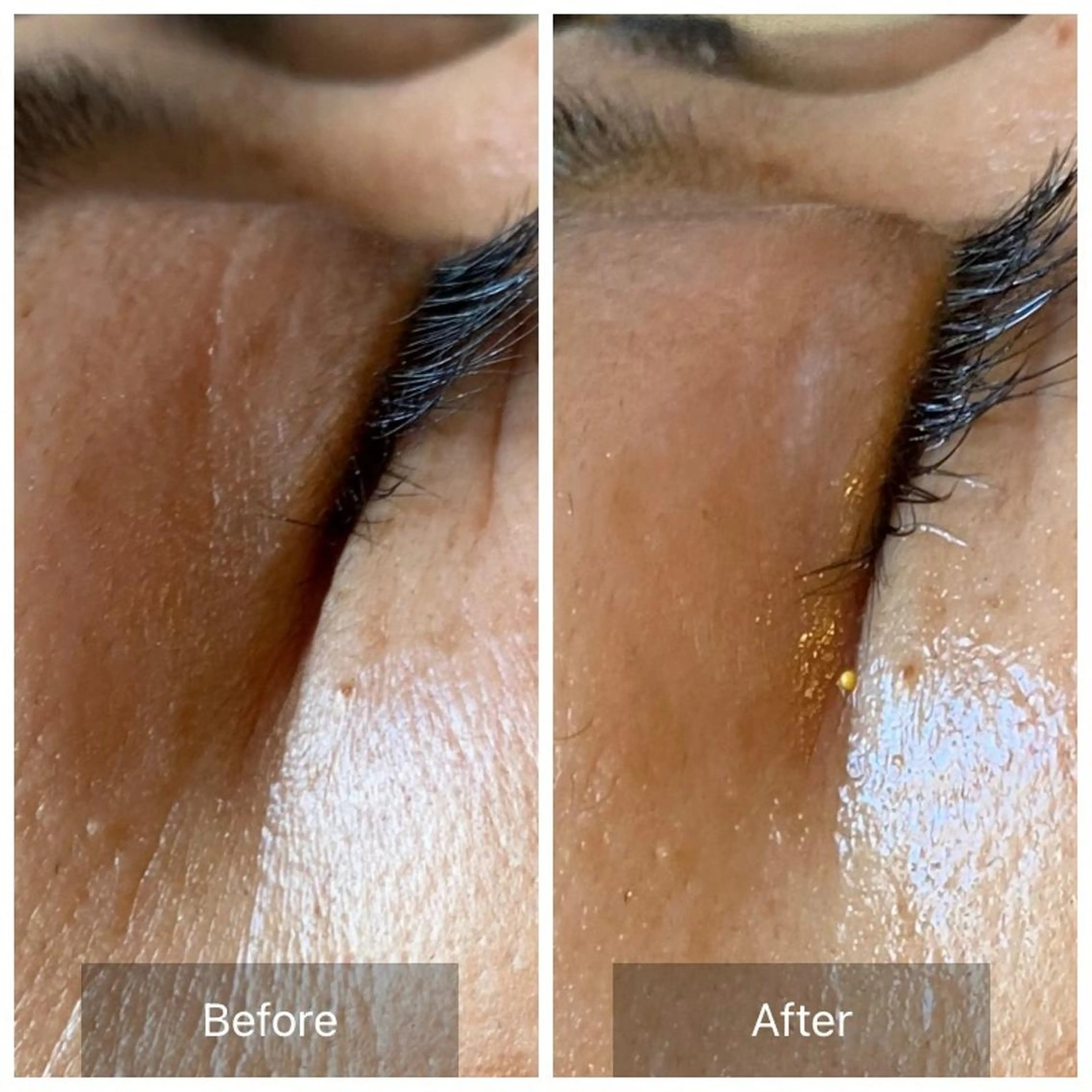 毛穴から始める肌メン テマンダリンオレンジのエステ・リラクイメージ