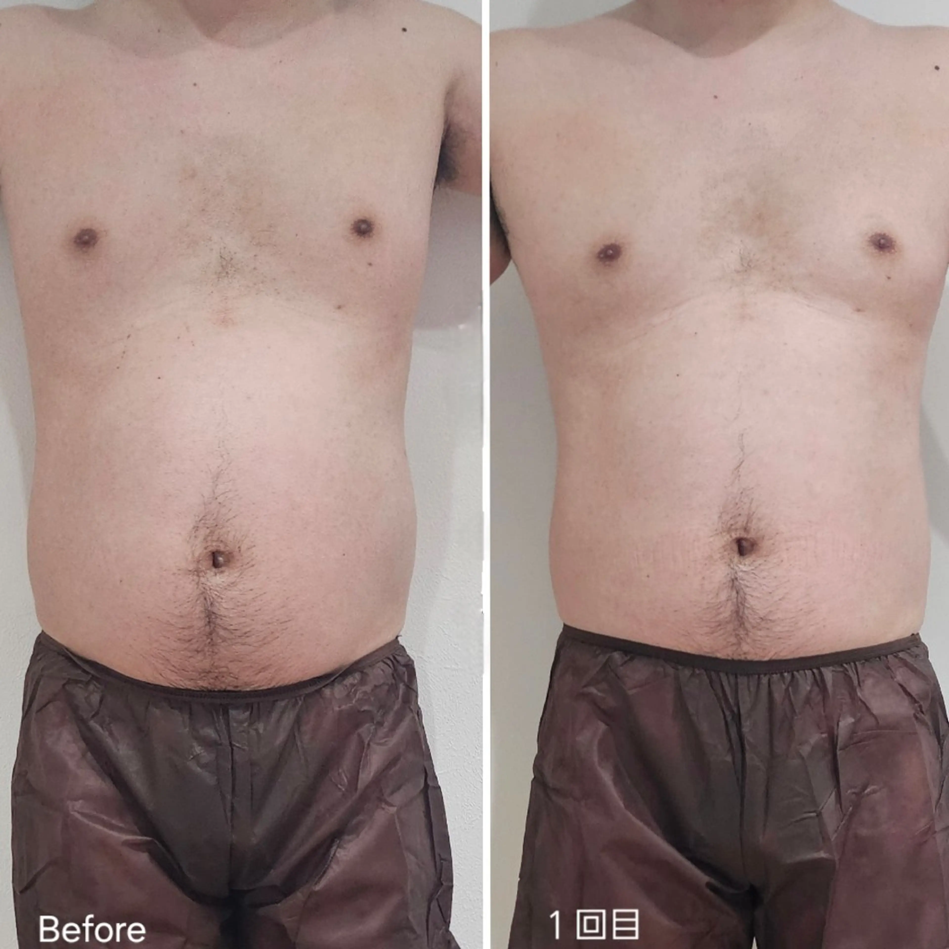 その他 脂肪冷却 & 脱毛 AYUMIのその他イメージ