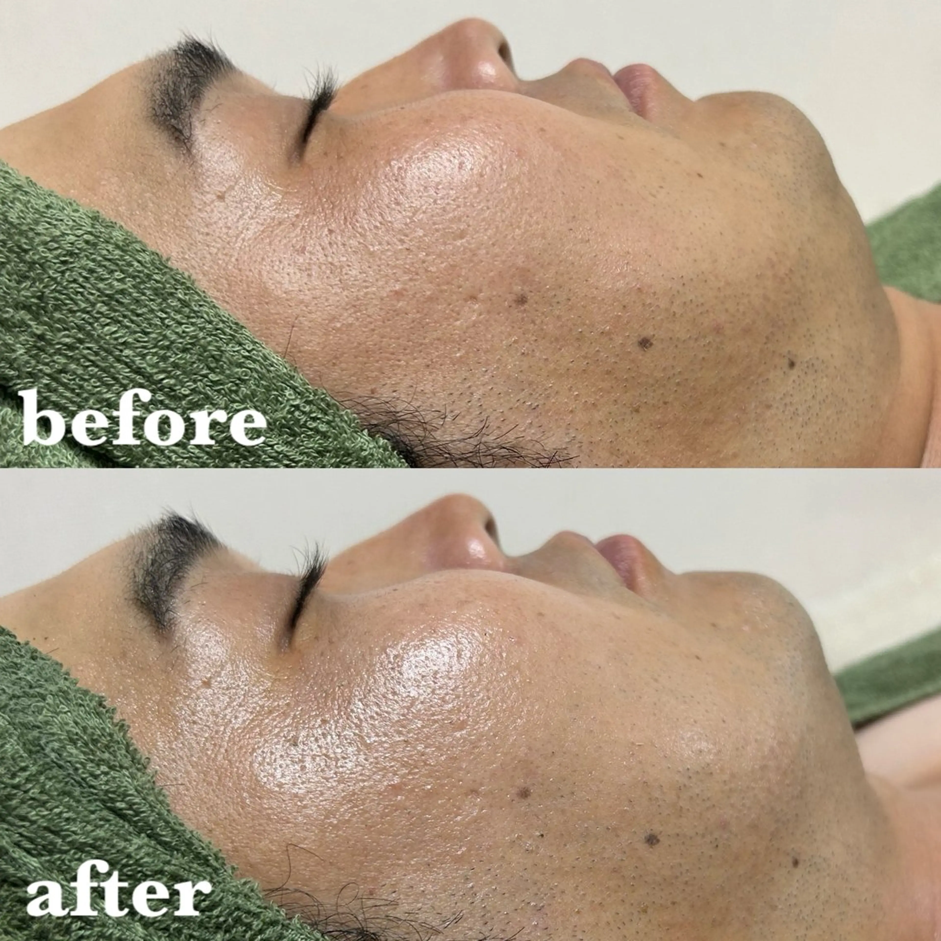 メンズ 肌質改善＆脱毛 【M Mondo】のエステ・リラクイメージ