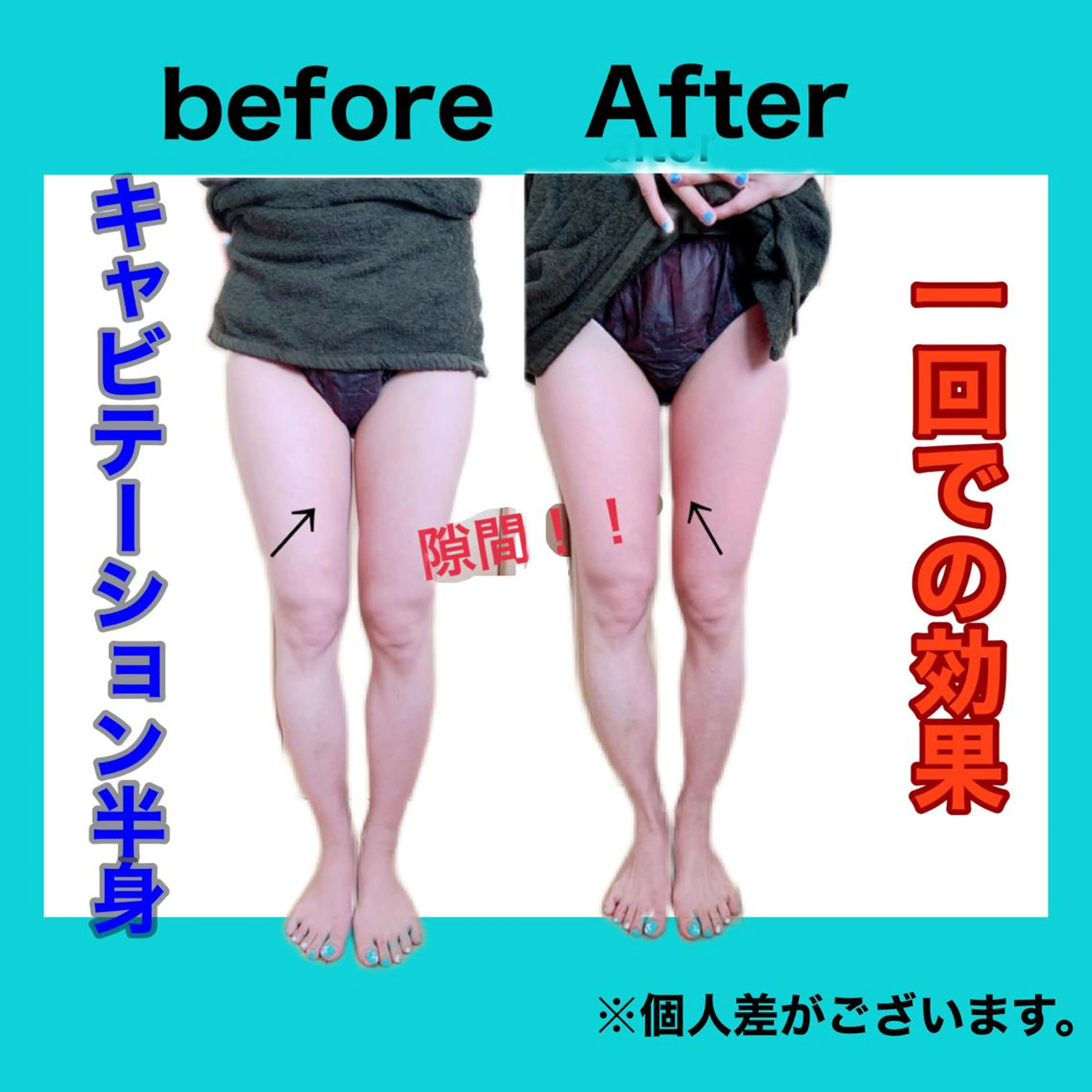 エステ リラク 痩身/脱毛/ネイル HARUKAのエステ・リラクイメージ