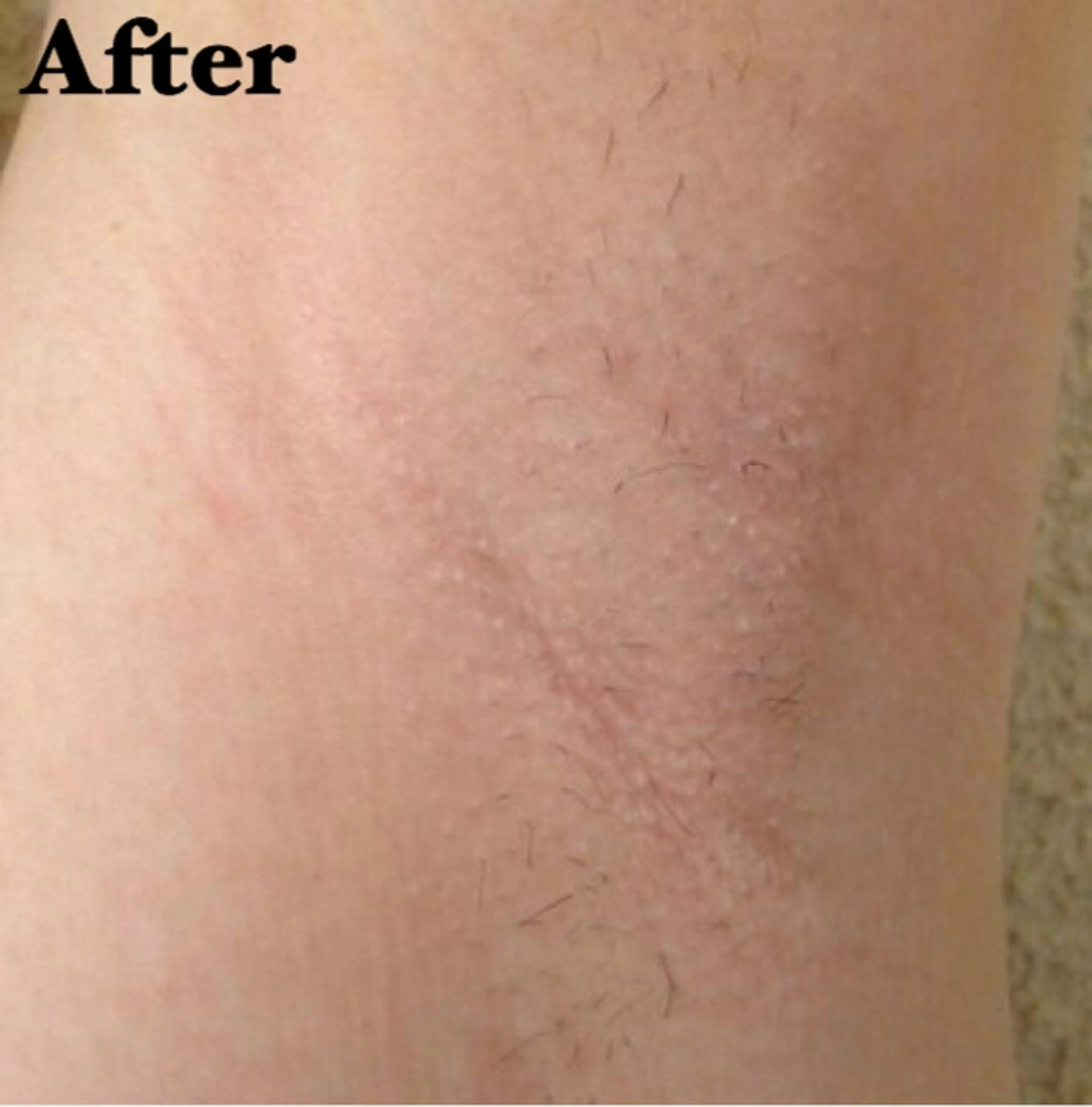 MIMI 吉祥寺本店のエステ・リラクイメージ