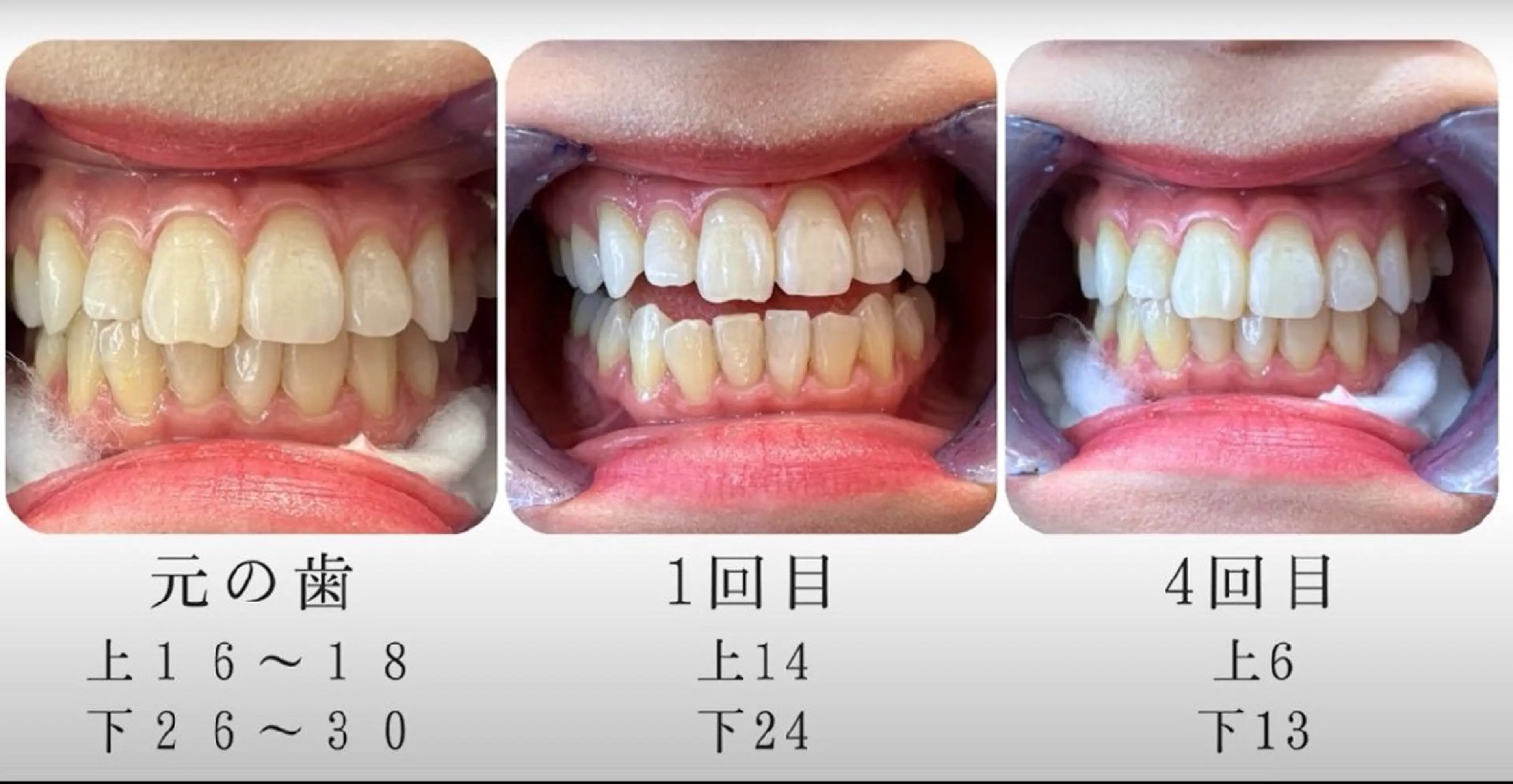 ecxia  white 　広島袋町店所属・セルフホワイトニング エクシア広島袋町店のその他イメージ