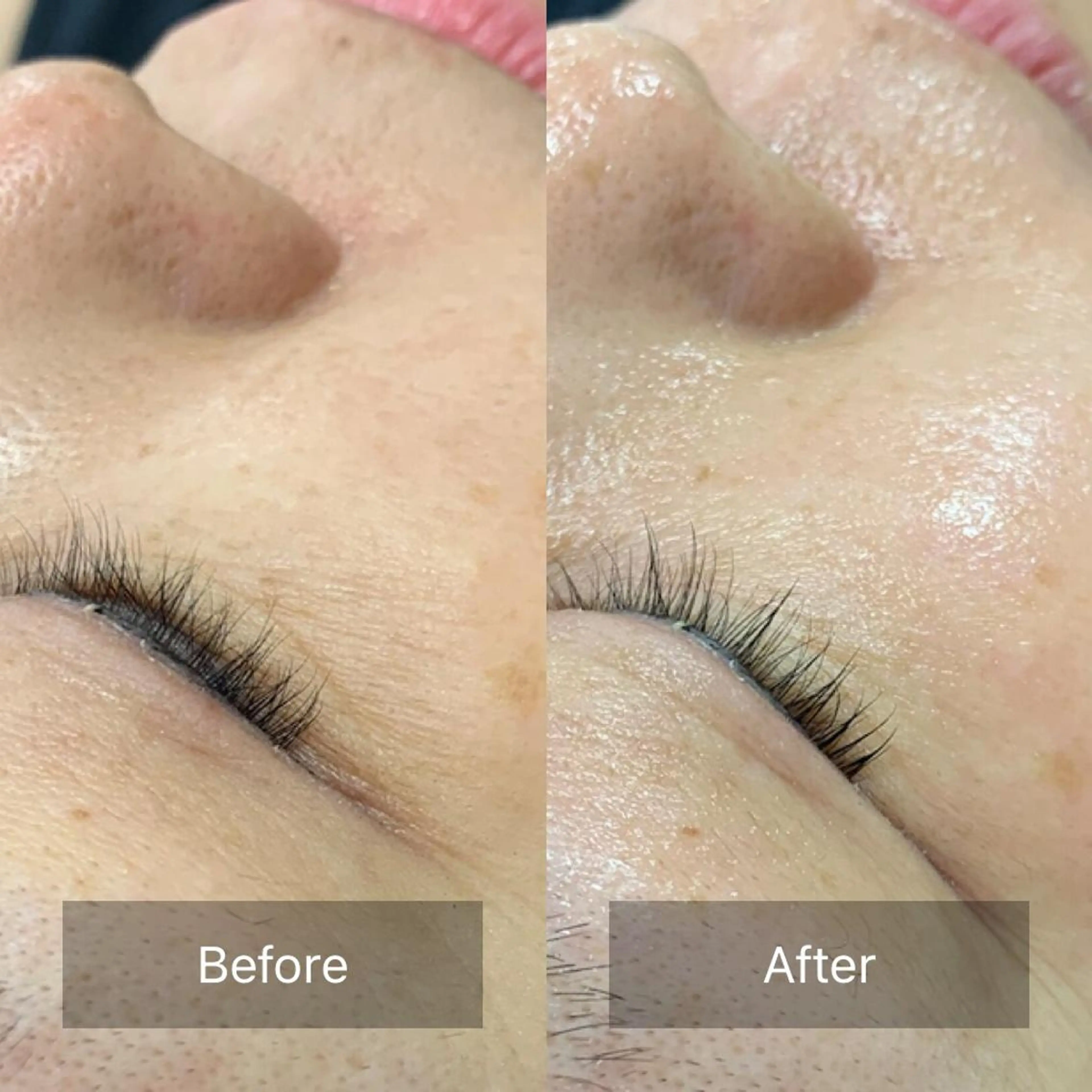 乾燥が気になる方必見‼️針を使わない、注入美容！天然微細針入美容液 導入★ヒト幹細胞培養液入マスク付！60分の写真