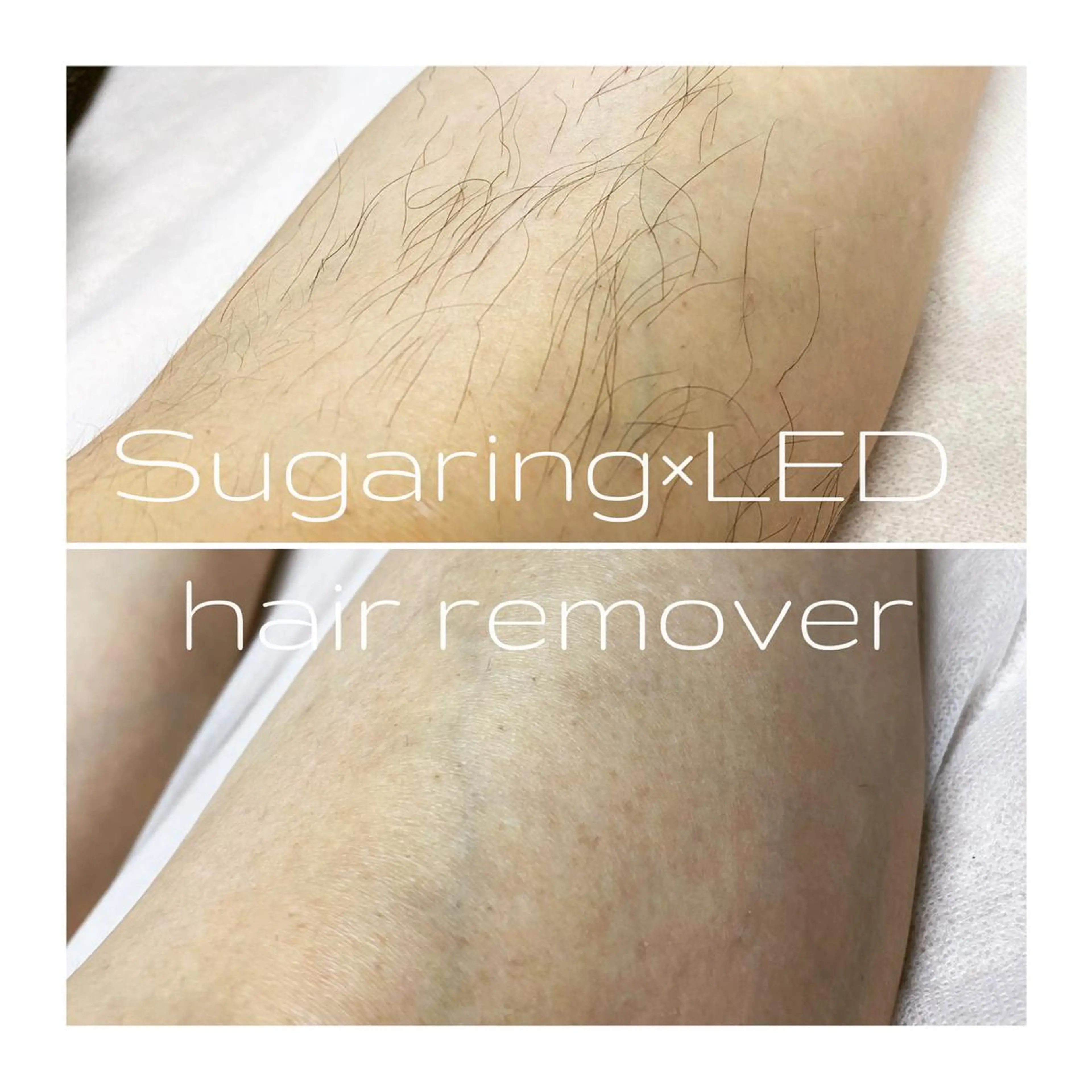 Sugaring / HILOT TAOのエステ・リラクイメージ