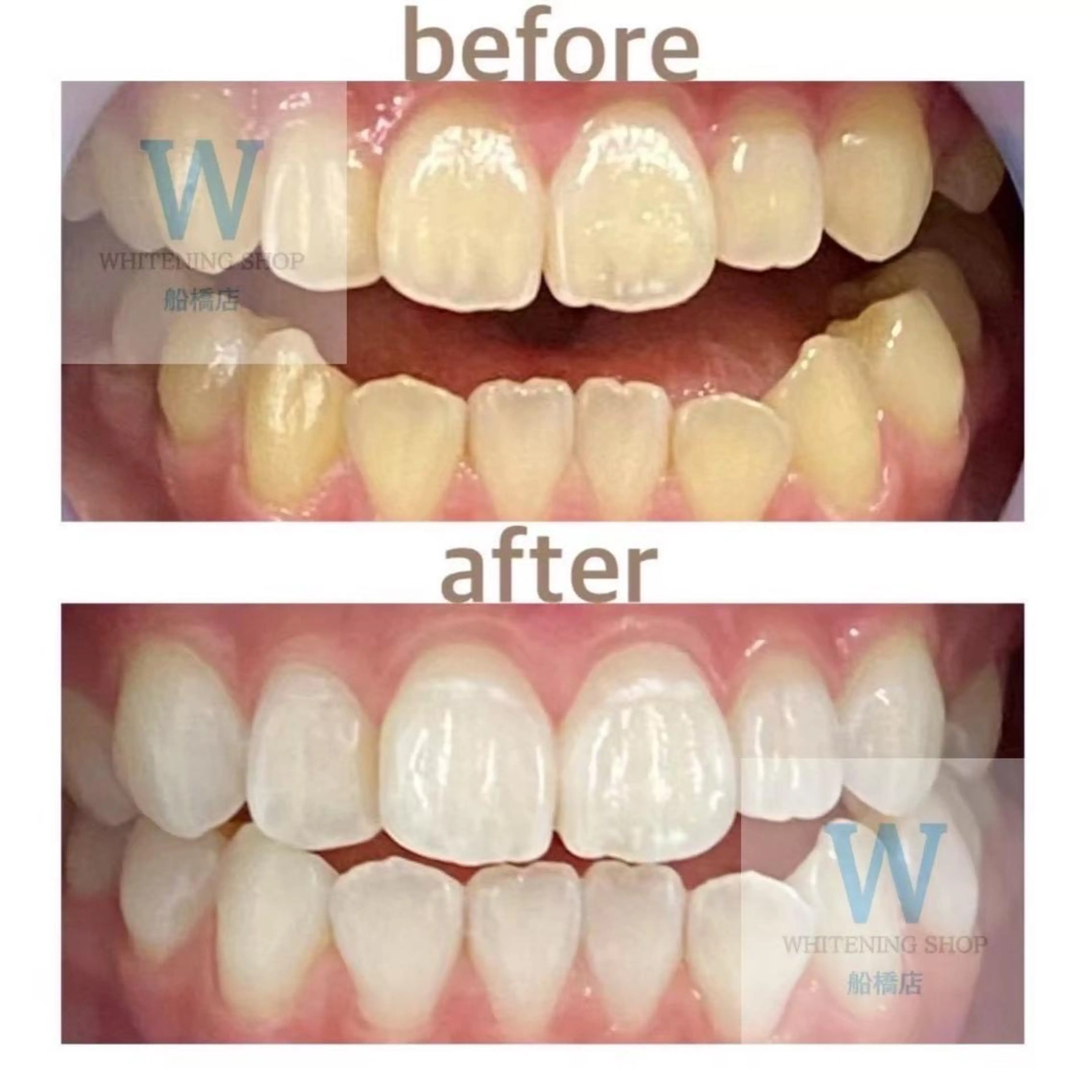 エステ リラク ホワイトニング ショップ船橋２号店のエステ・リラクイメージ