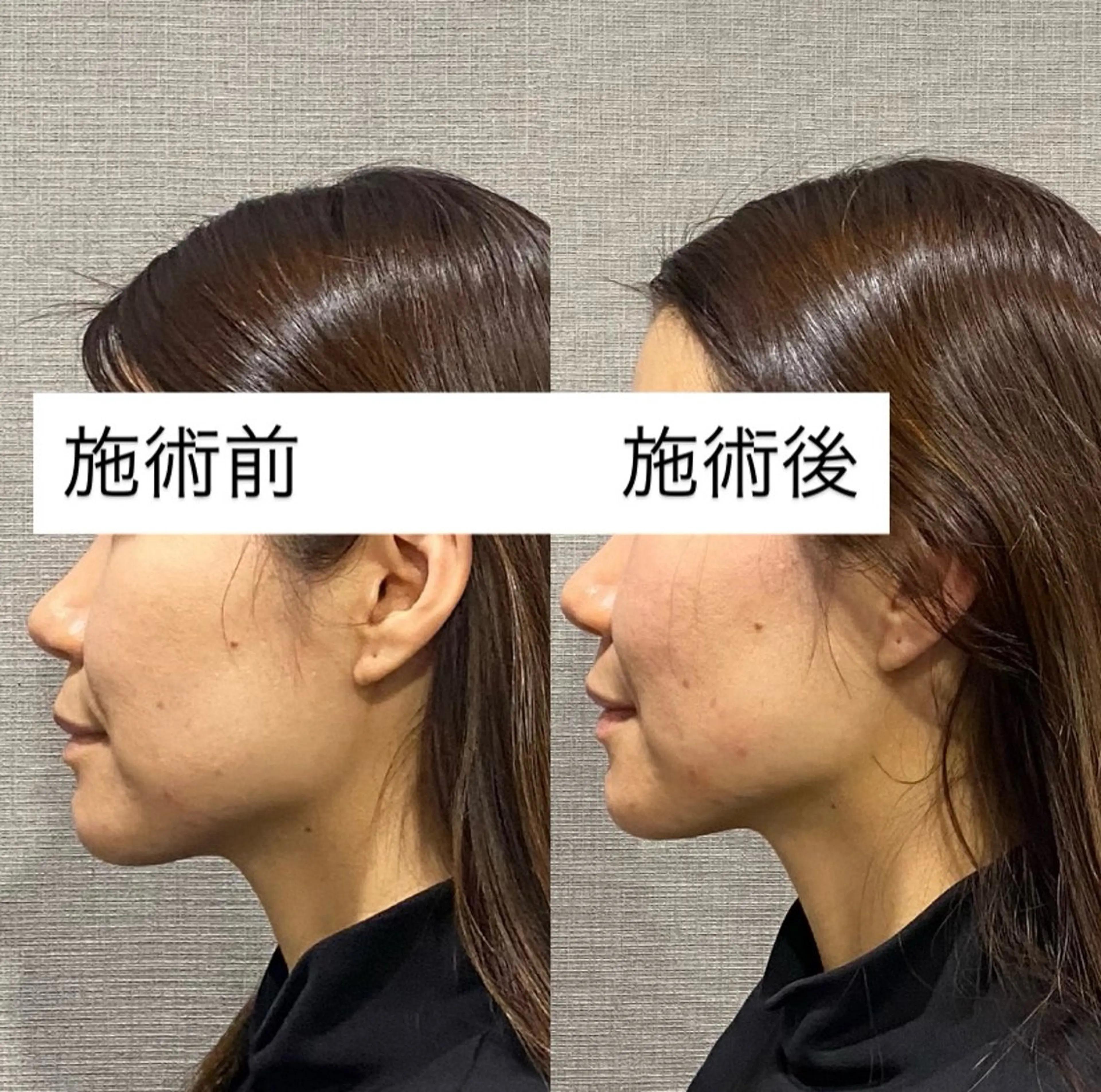 エステ リラク 肌質改善専門 ハーブ /毛穴洗浄 リエイトのエステ・リラクイメージ