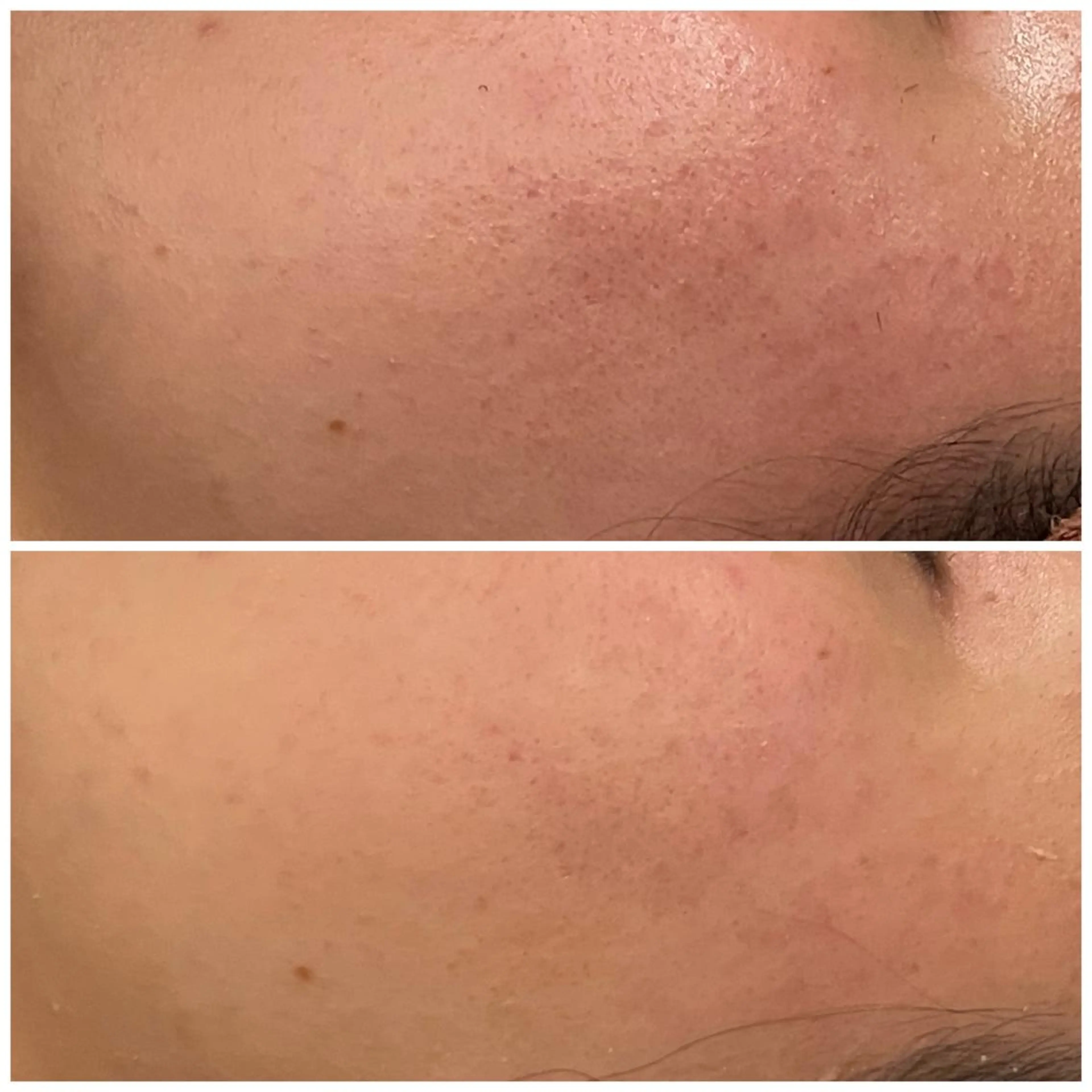 セミロング カラー パーマ ヘアアレンジ メンズ ネイル マツエク・マツパ アイブロウ 3か月で肌革命👼 ニキビ専門店💫のエステ・リラクイメージ