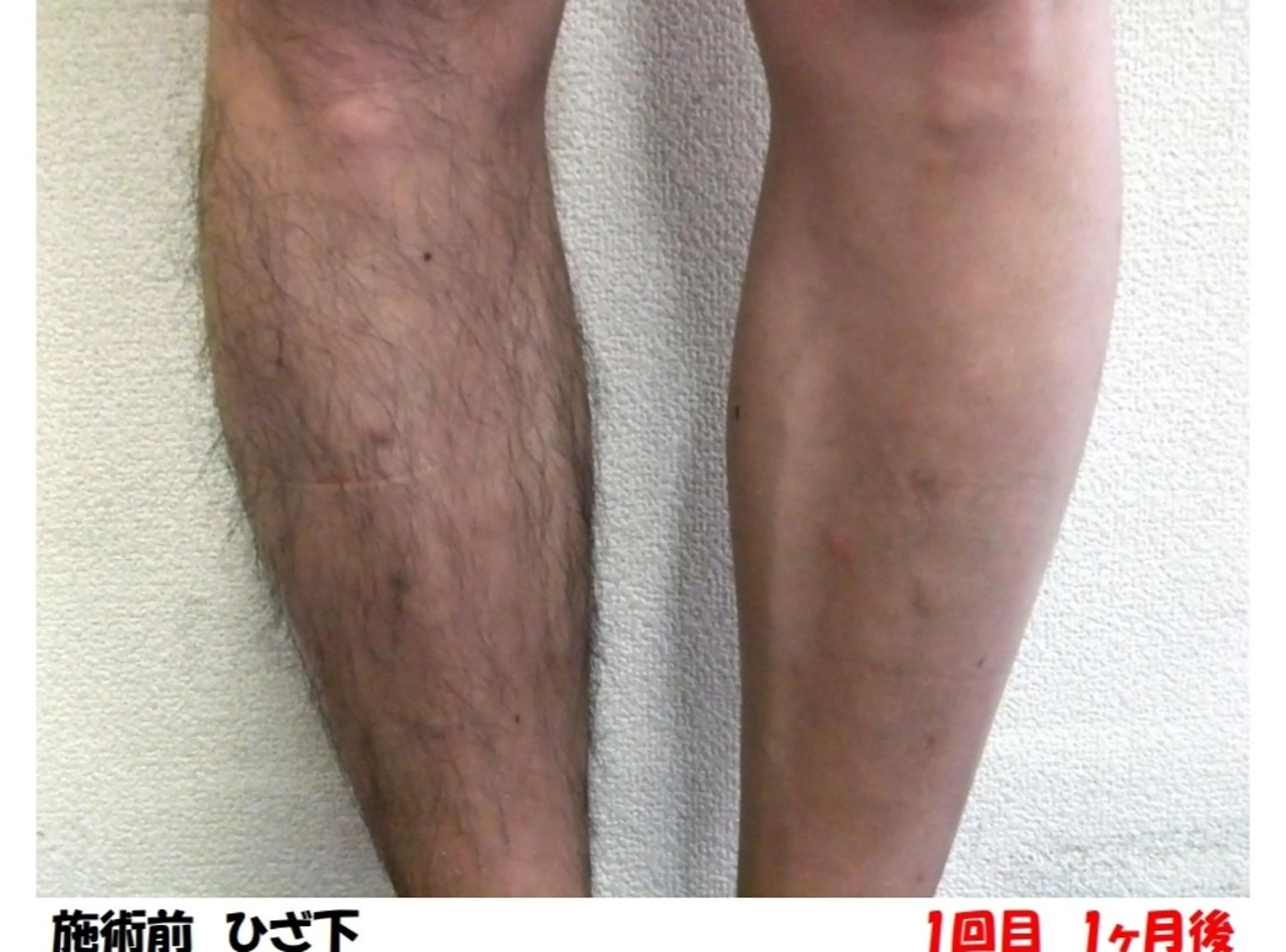 サロン リベル YUKAのエステ・リラクイメージ