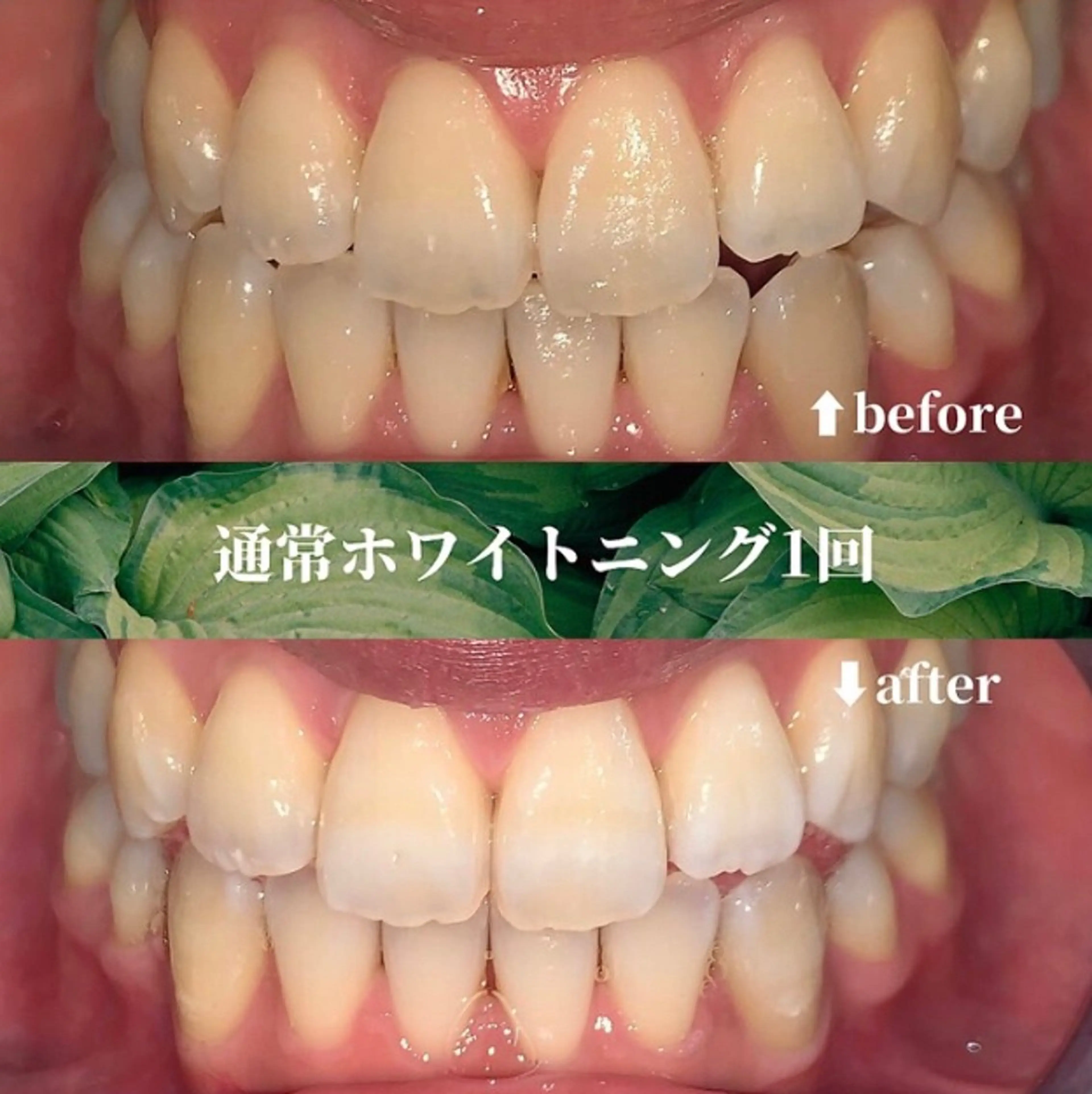 futaba ホワイトニング/天神のエステ・リラクイメージ