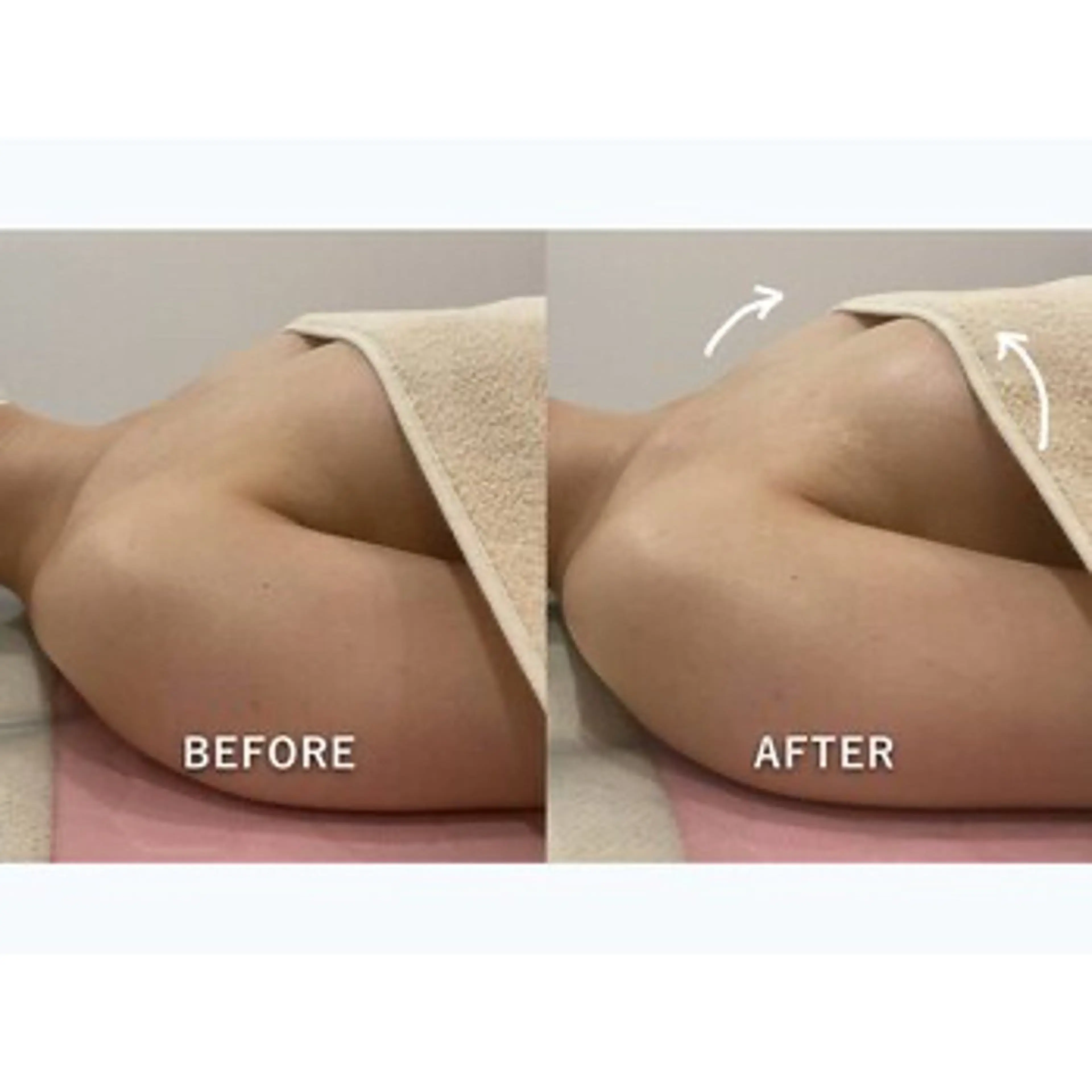 【痩身/ダイエット】 オーバイワン横浜🍓のエステ・リラクイメージ