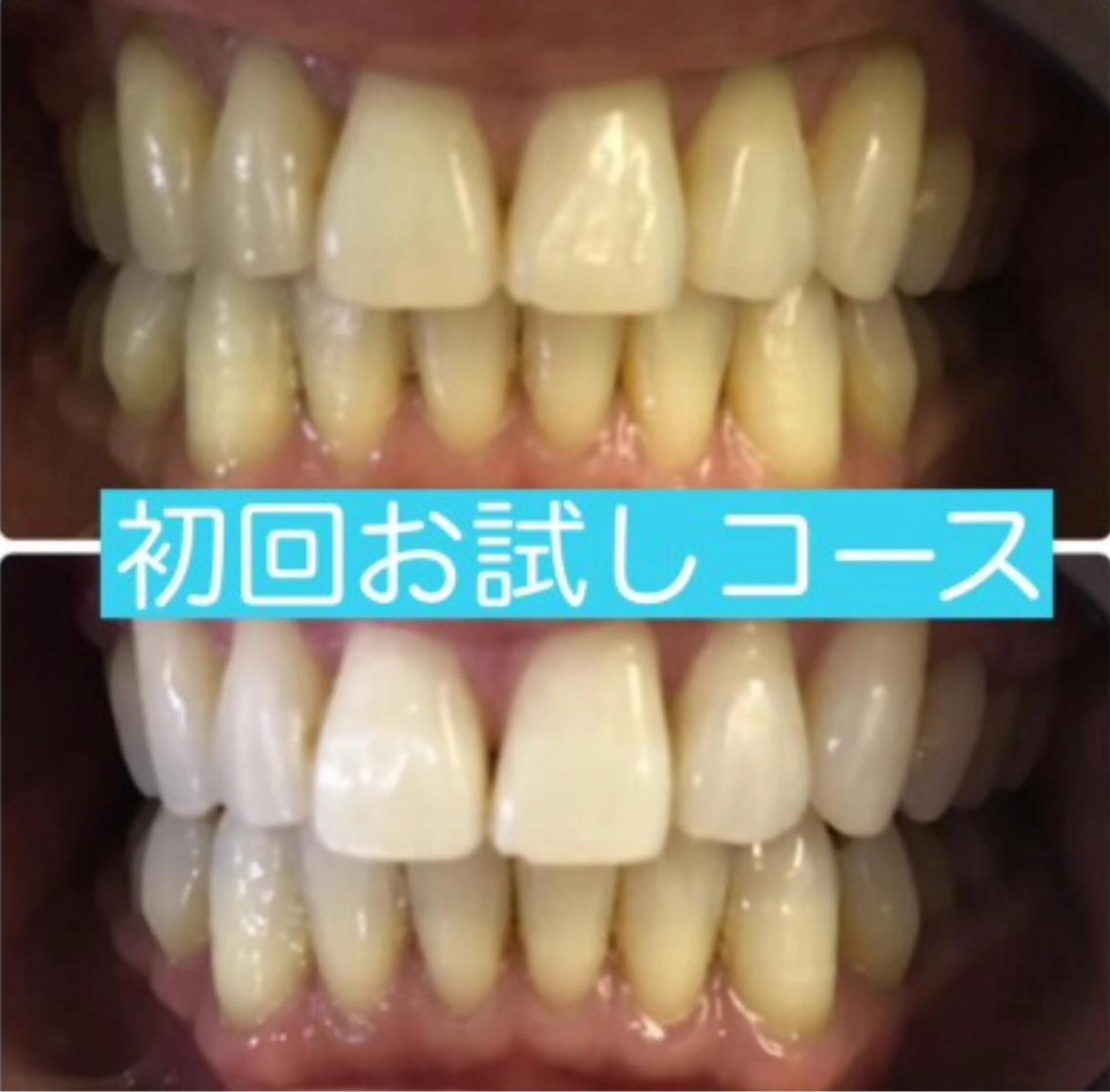 Venus Beauty銀座のマツエク・マツパデザイン