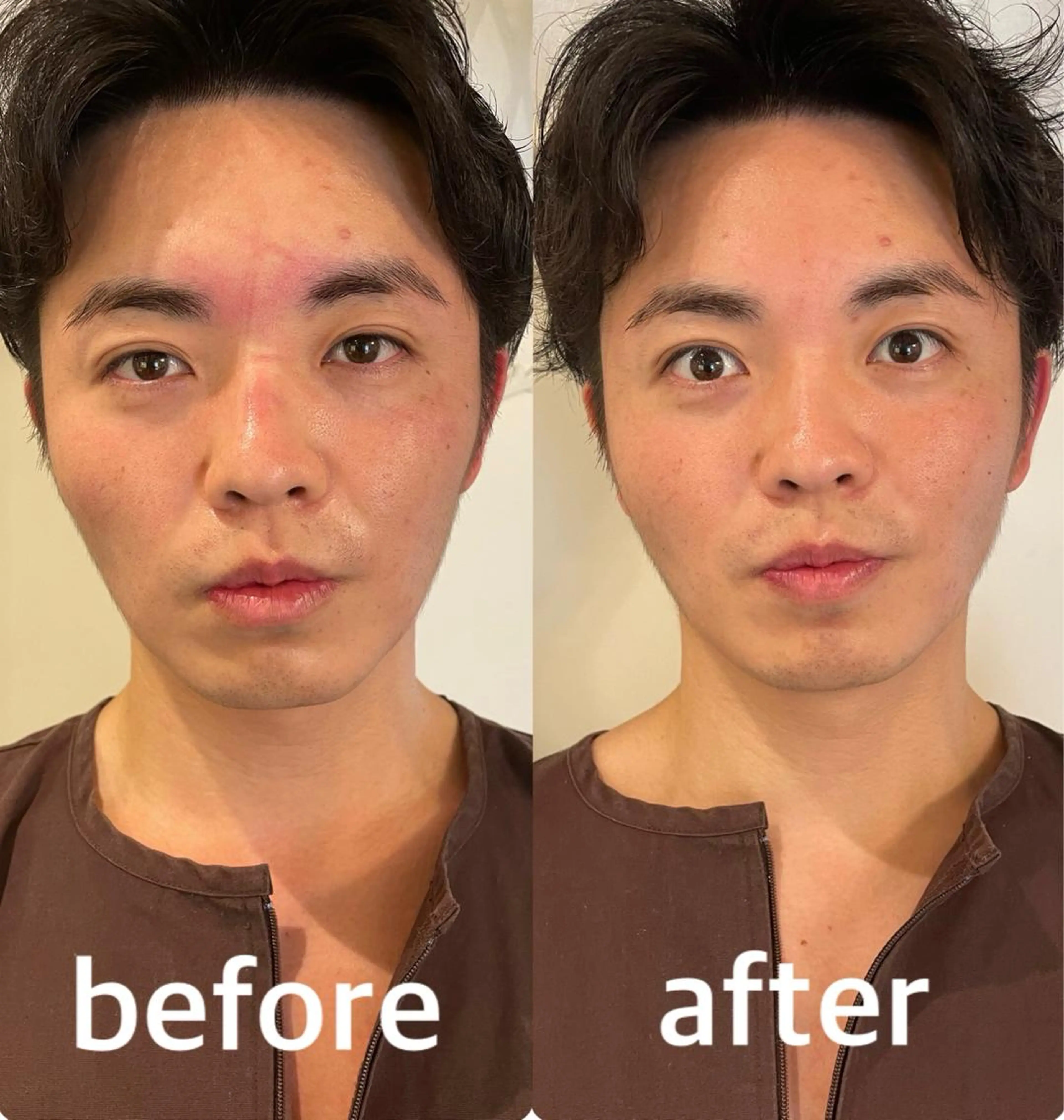 美容鍼灸サロン mahoroba院長のエステ・リラクイメージ