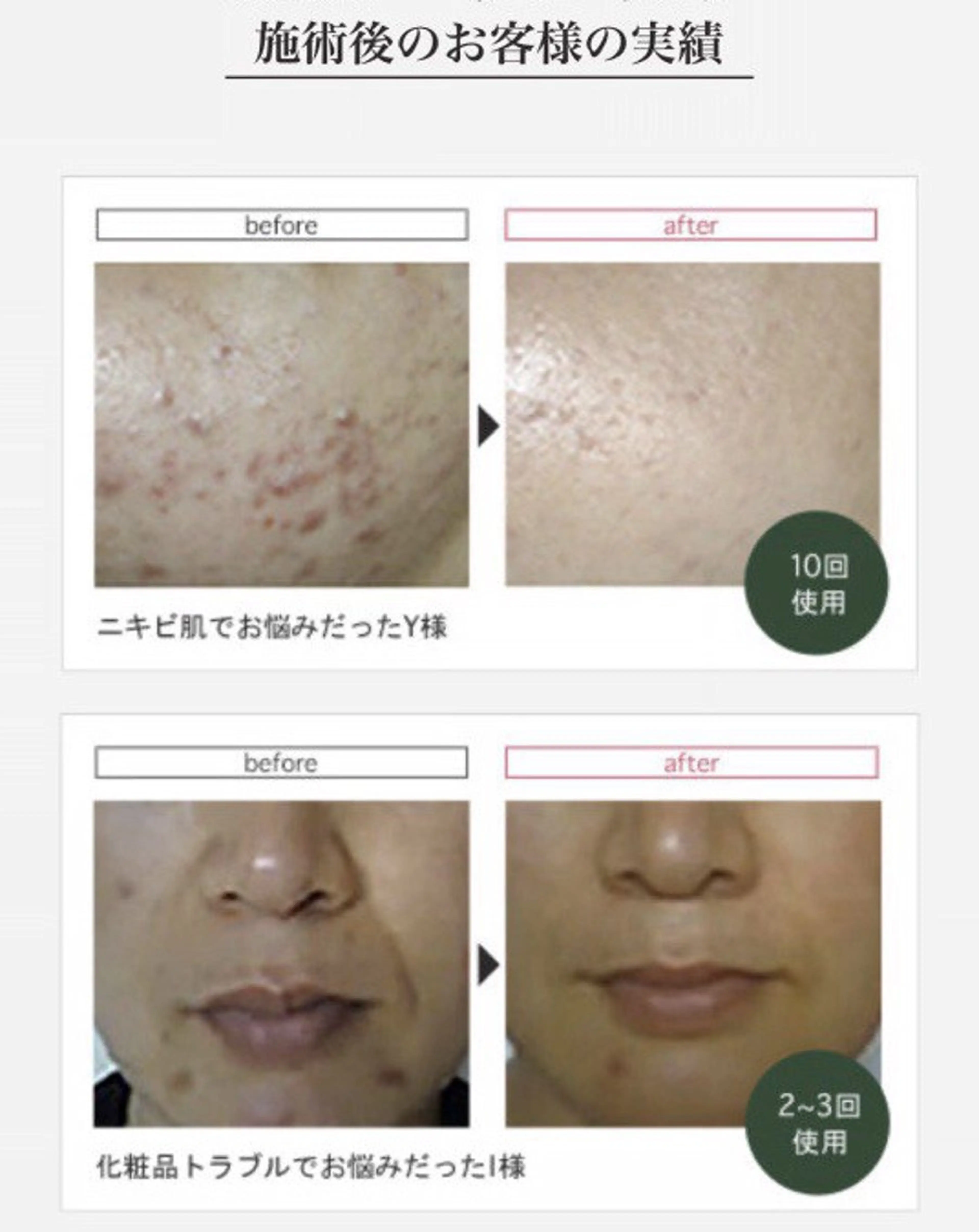 total beauty salon RIRE所属・古川 弥生のエステ・リラクイメージ