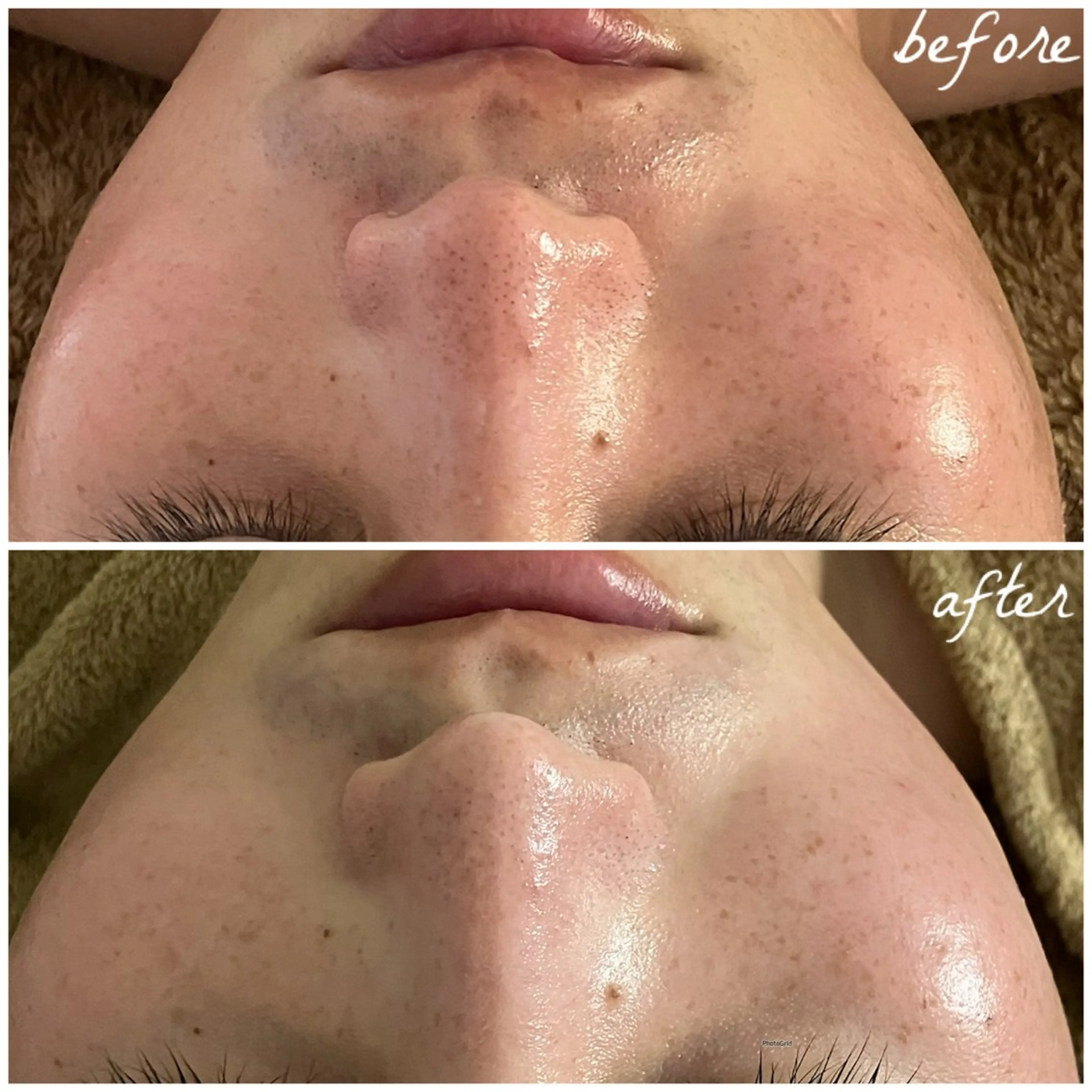 メンズ エステ メナード岐阜市茜部 杉浦のエステ・リラクイメージ