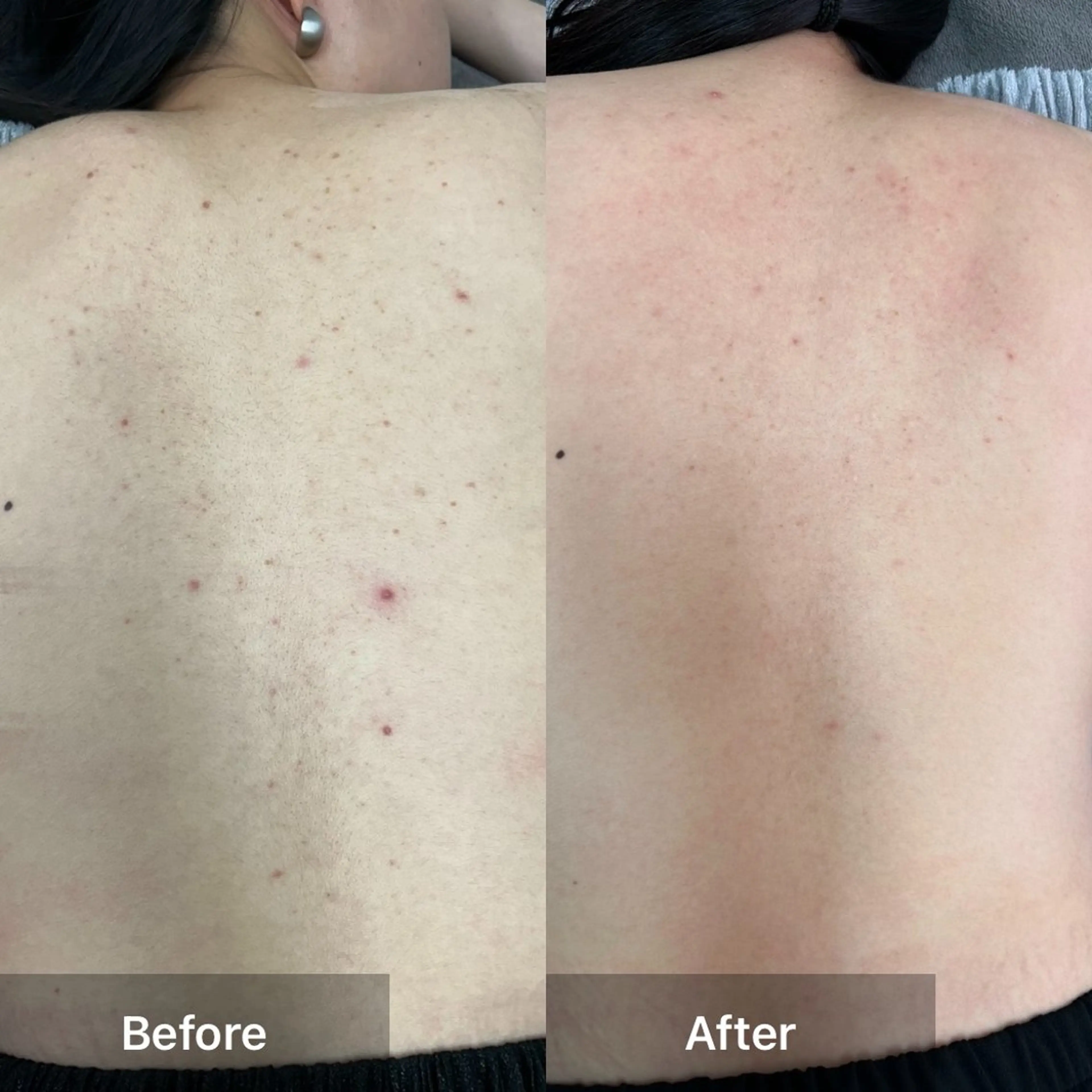 エステ ハーブピーリング 専門店MOKA所属・ハーブピーリング専門 MOKAのエステ・リラクイメージ