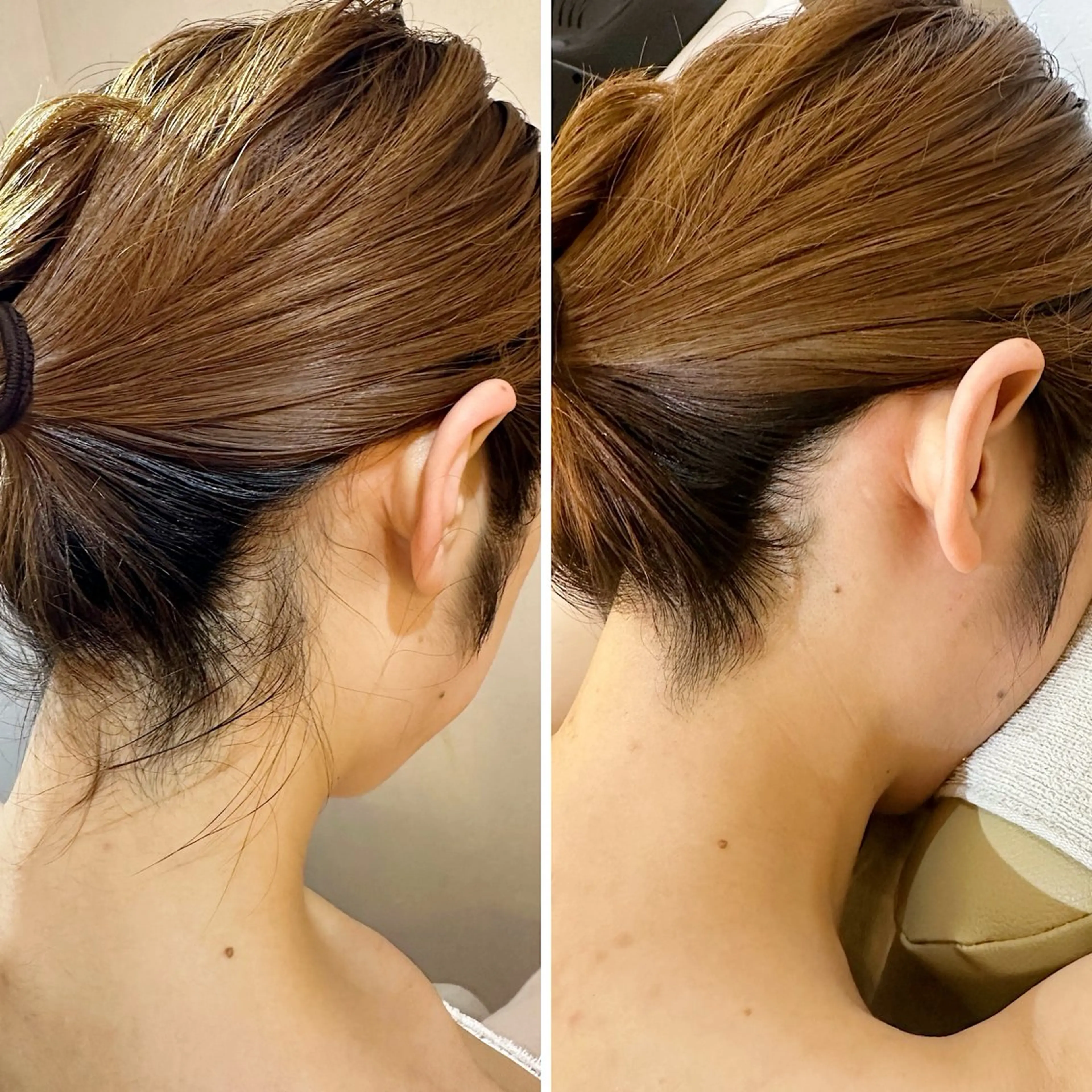 脱毛 うなじ脱毛/美肌脱毛 LABELのエステ・リラクイメージ