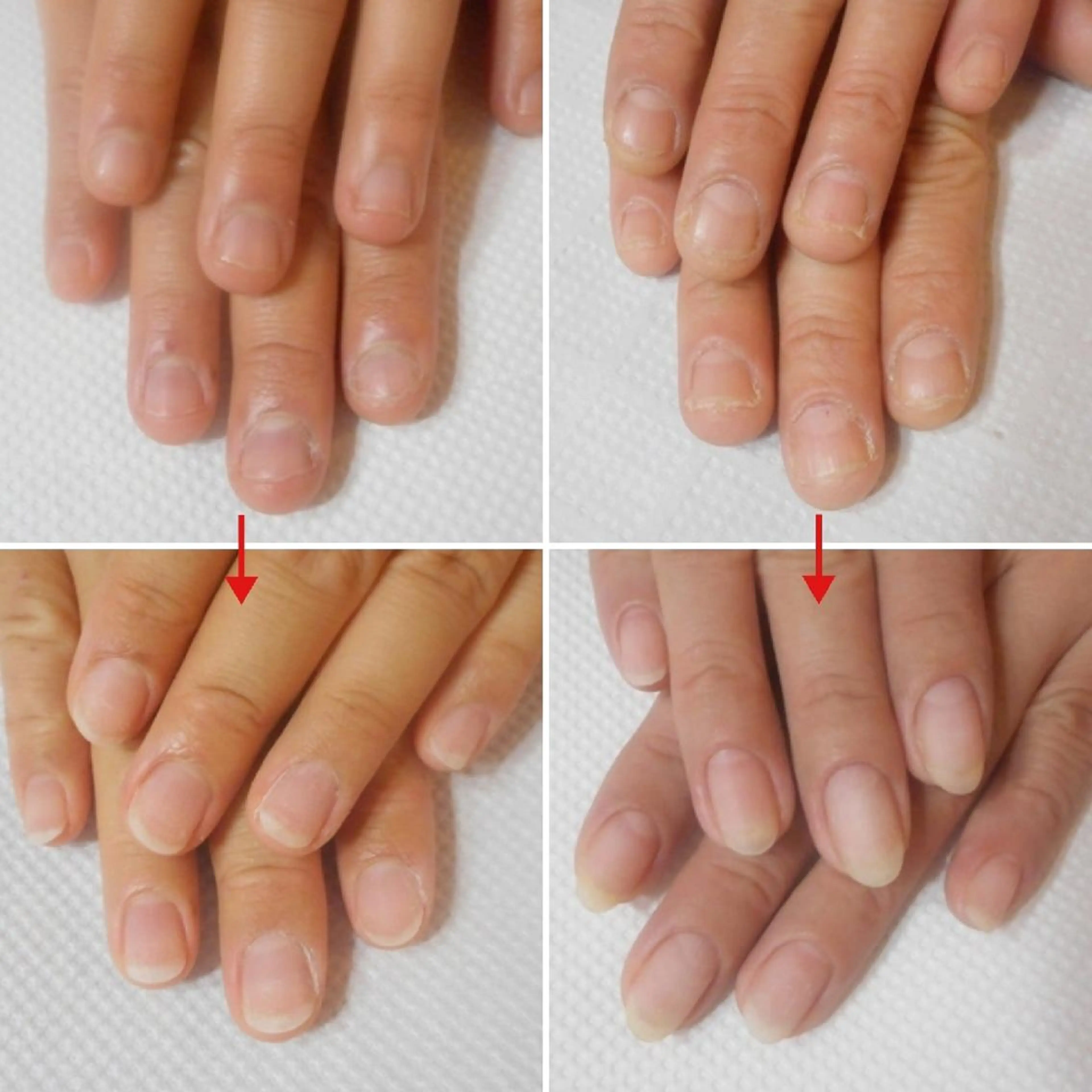 ネイル ネイルサロン アリュームのネイルデザイン