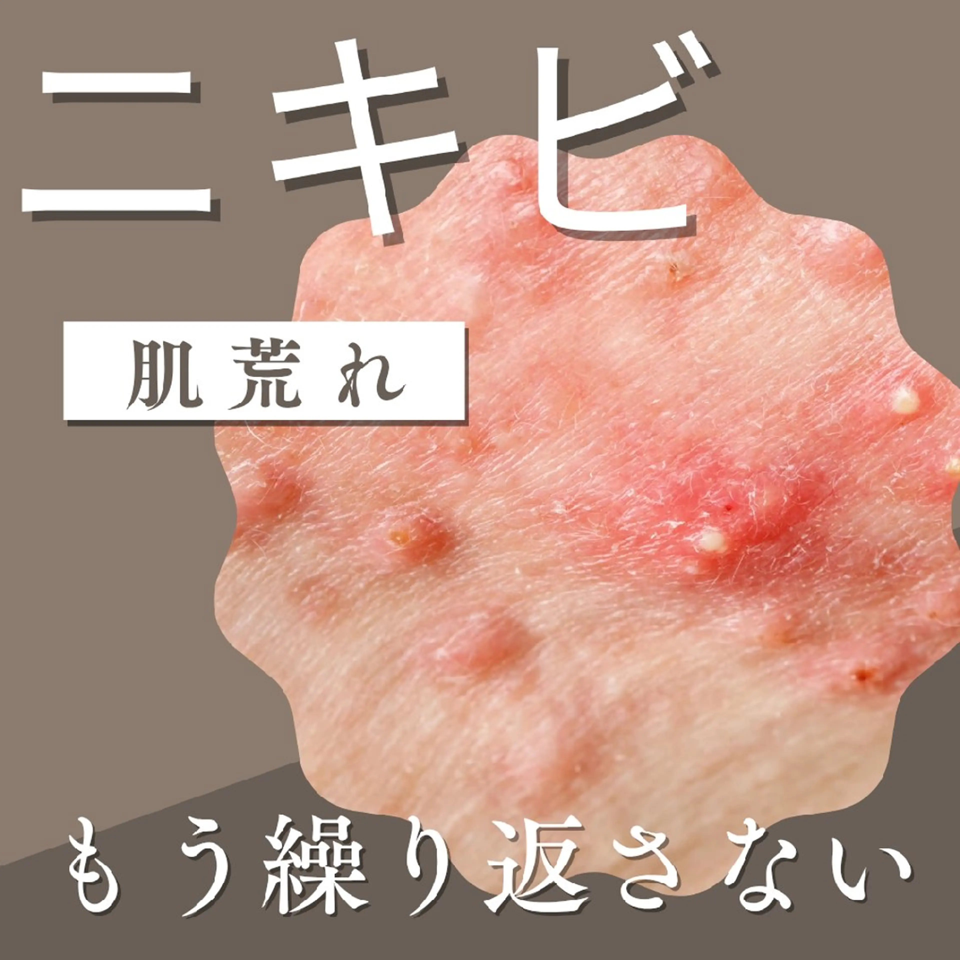 エステサロン NICOLIのエステ・リラクイメージ