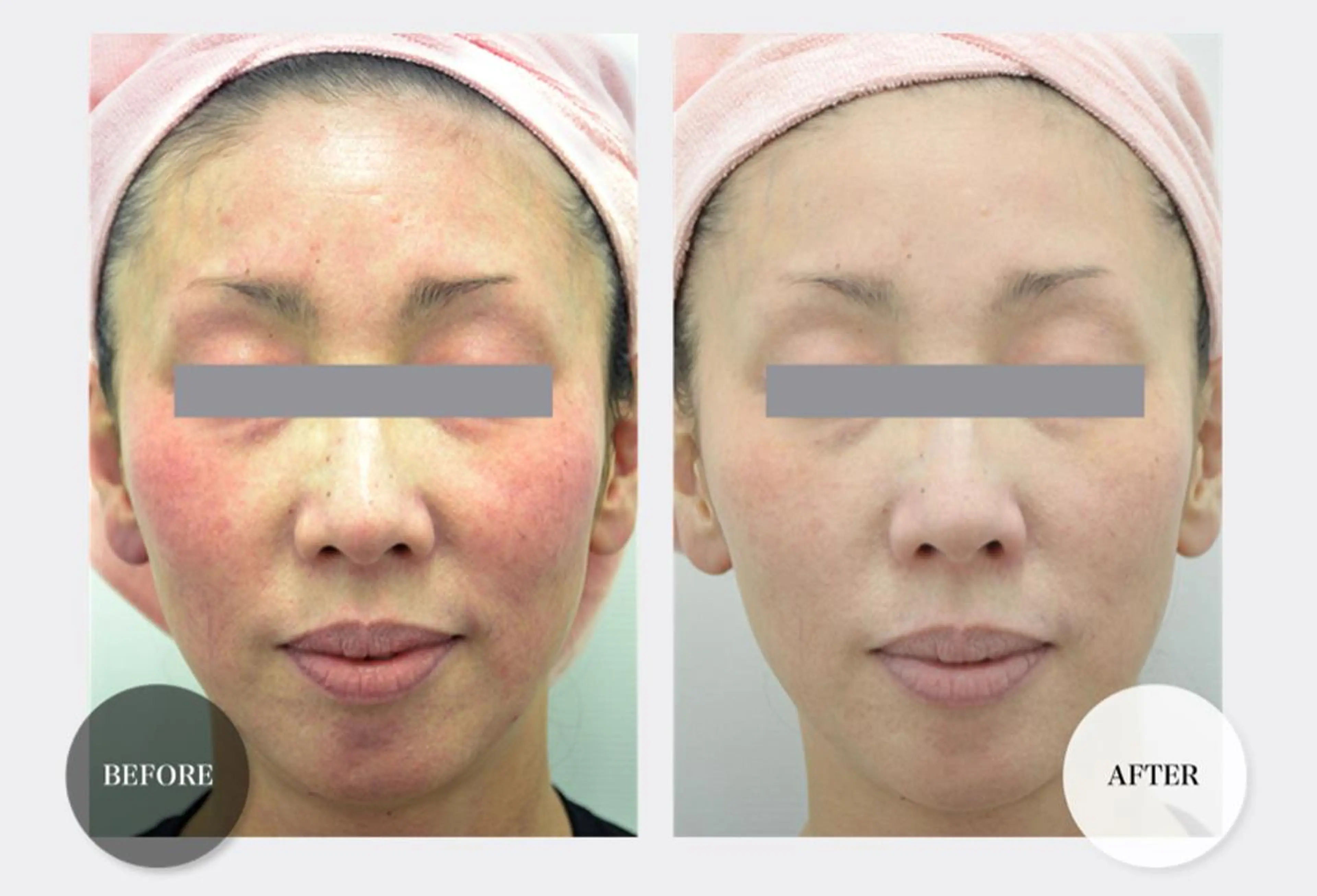 HappIness 遠赤外線ドームのエステ・リラクイメージ