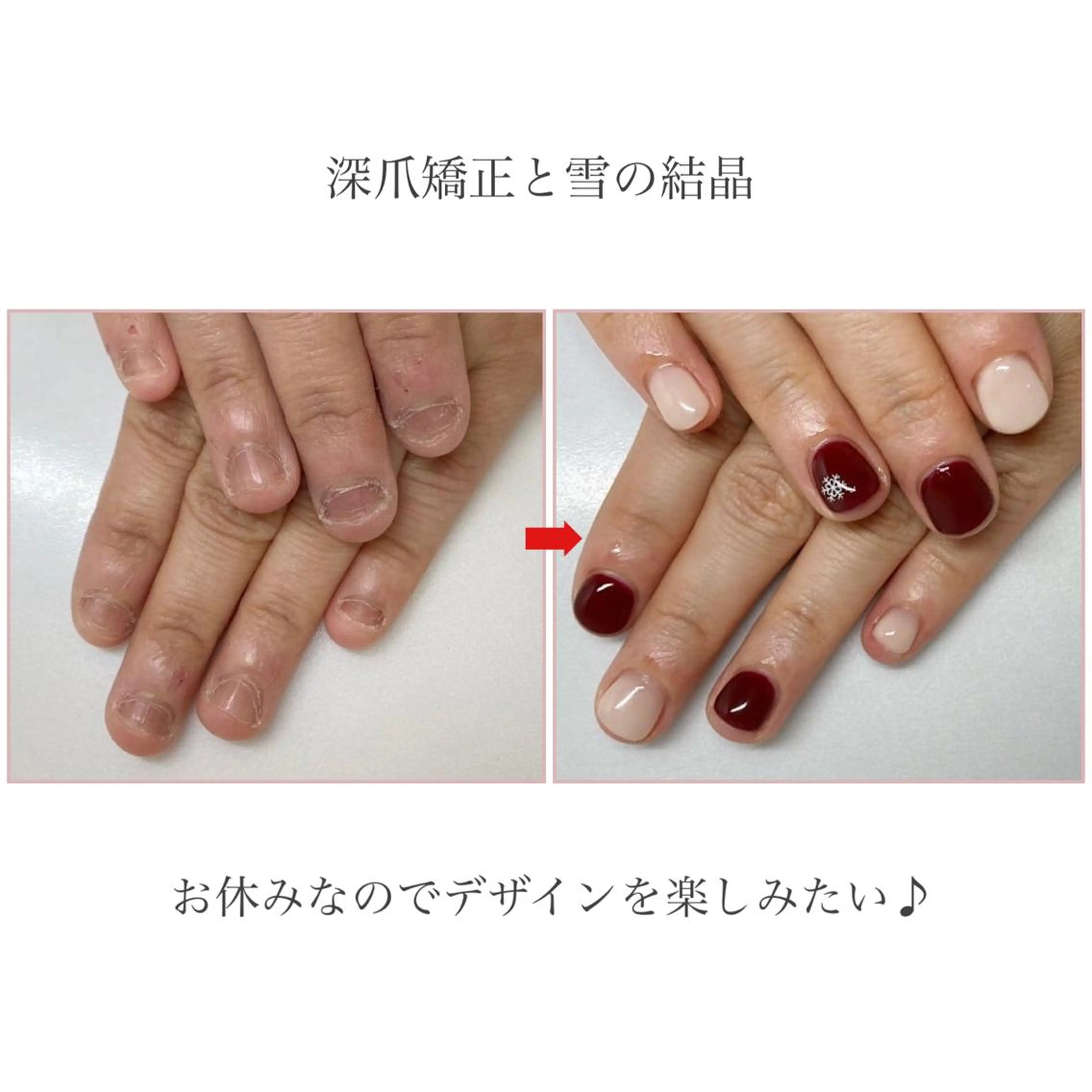 ネイル ネイルサロン アリュームのネイルデザイン