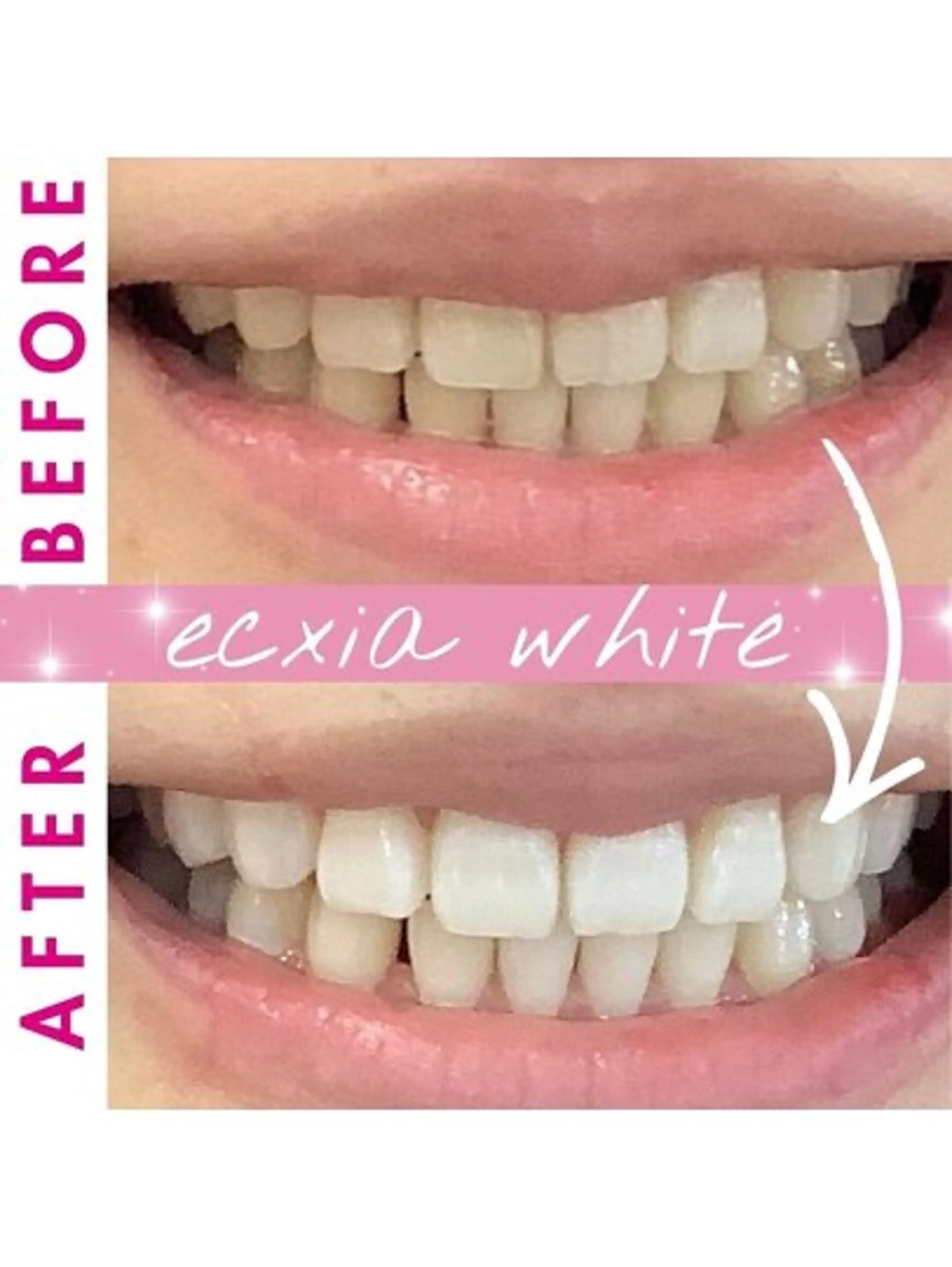 エクシア ホワイトニング西条店のその他イメージ