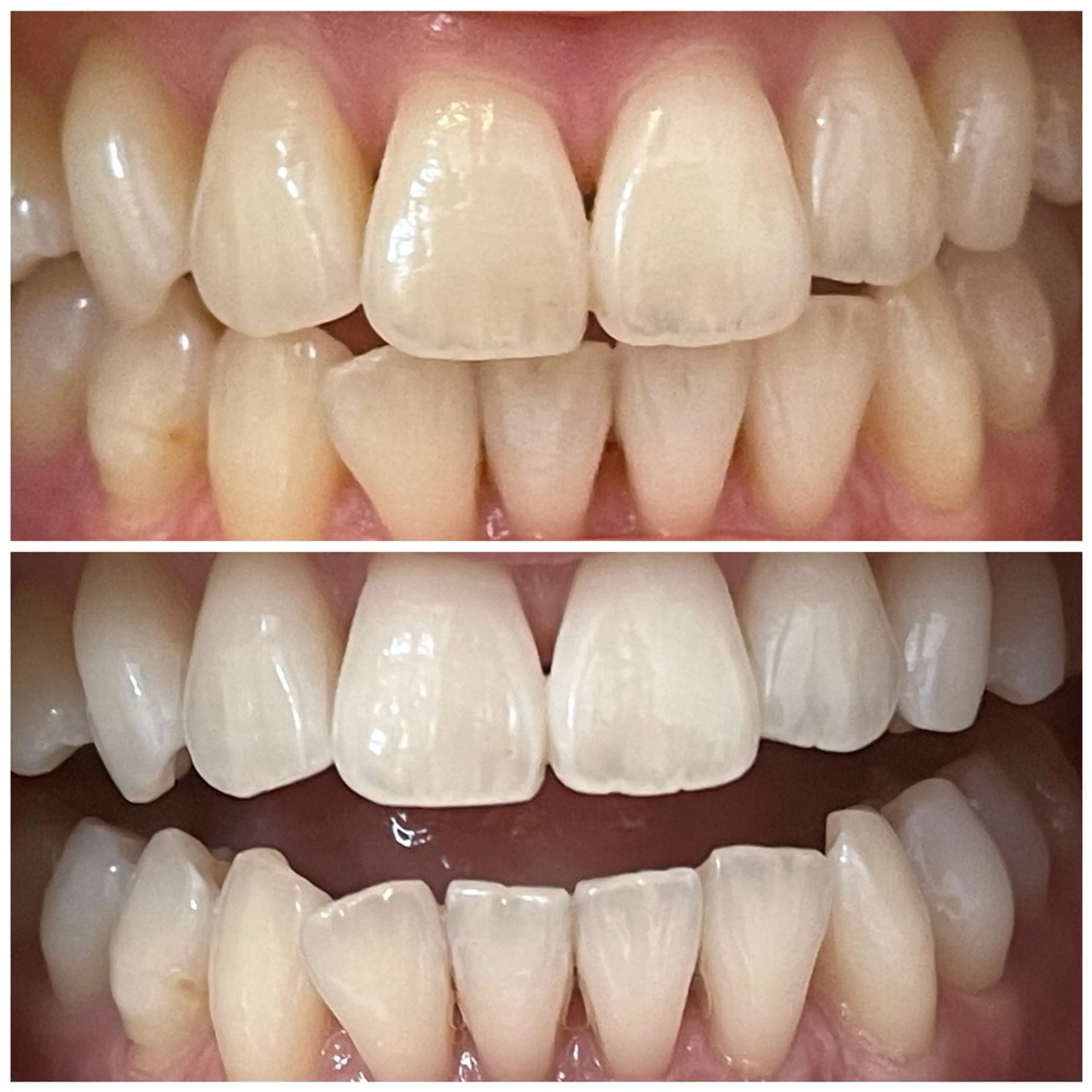 メンズ DIAMOND BEAUYのその他イメージ